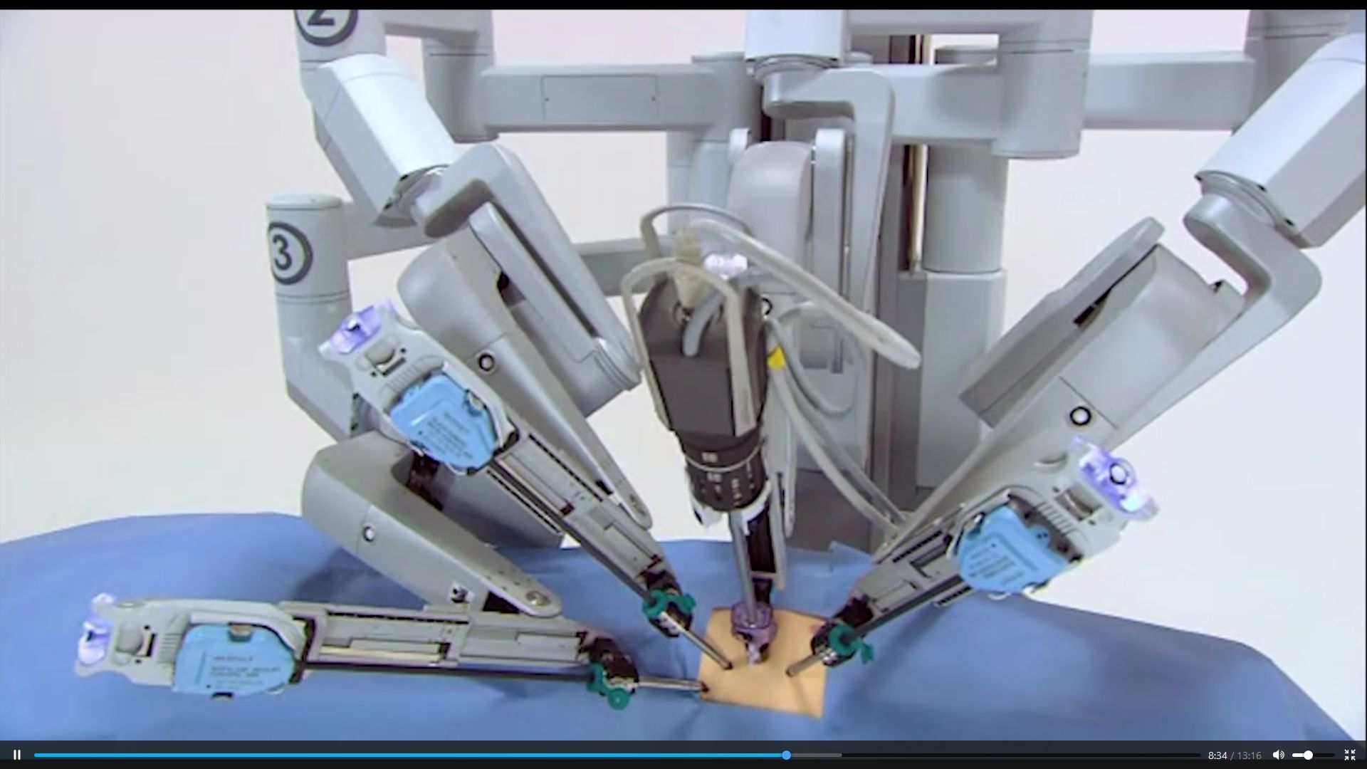 Апаратът за роботизирана хирургия в МУ-Плевен