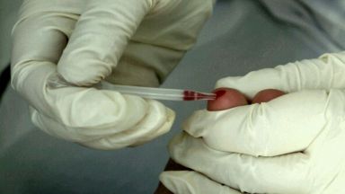 От новорегистрираните 86 са се инфектирали по сексуален път а