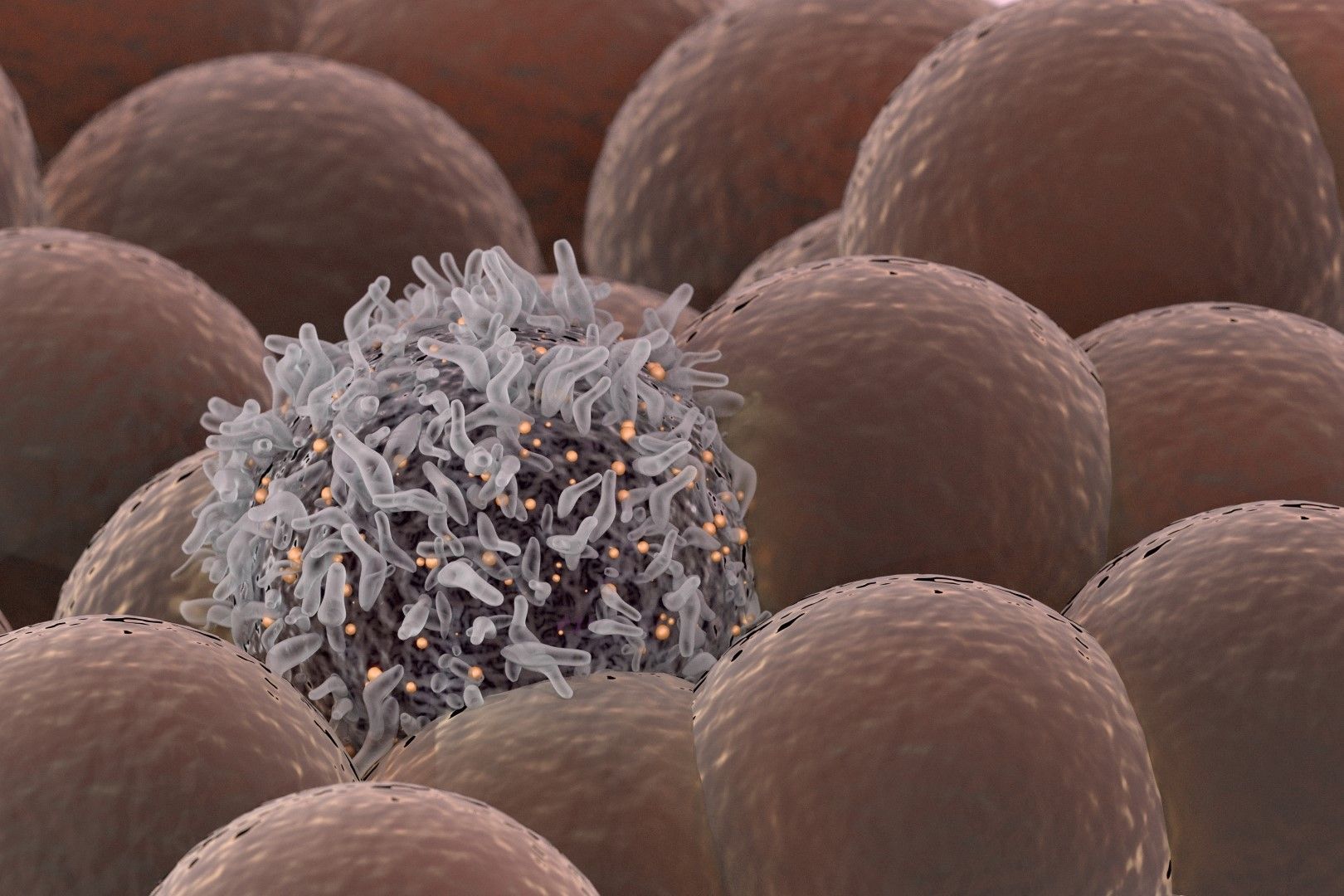 Здрави клетки, сред които се е появила ракова клетка
