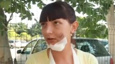 Млада жена, блъсната на пешеходна пътека, се страхува, че ще потулят случая
