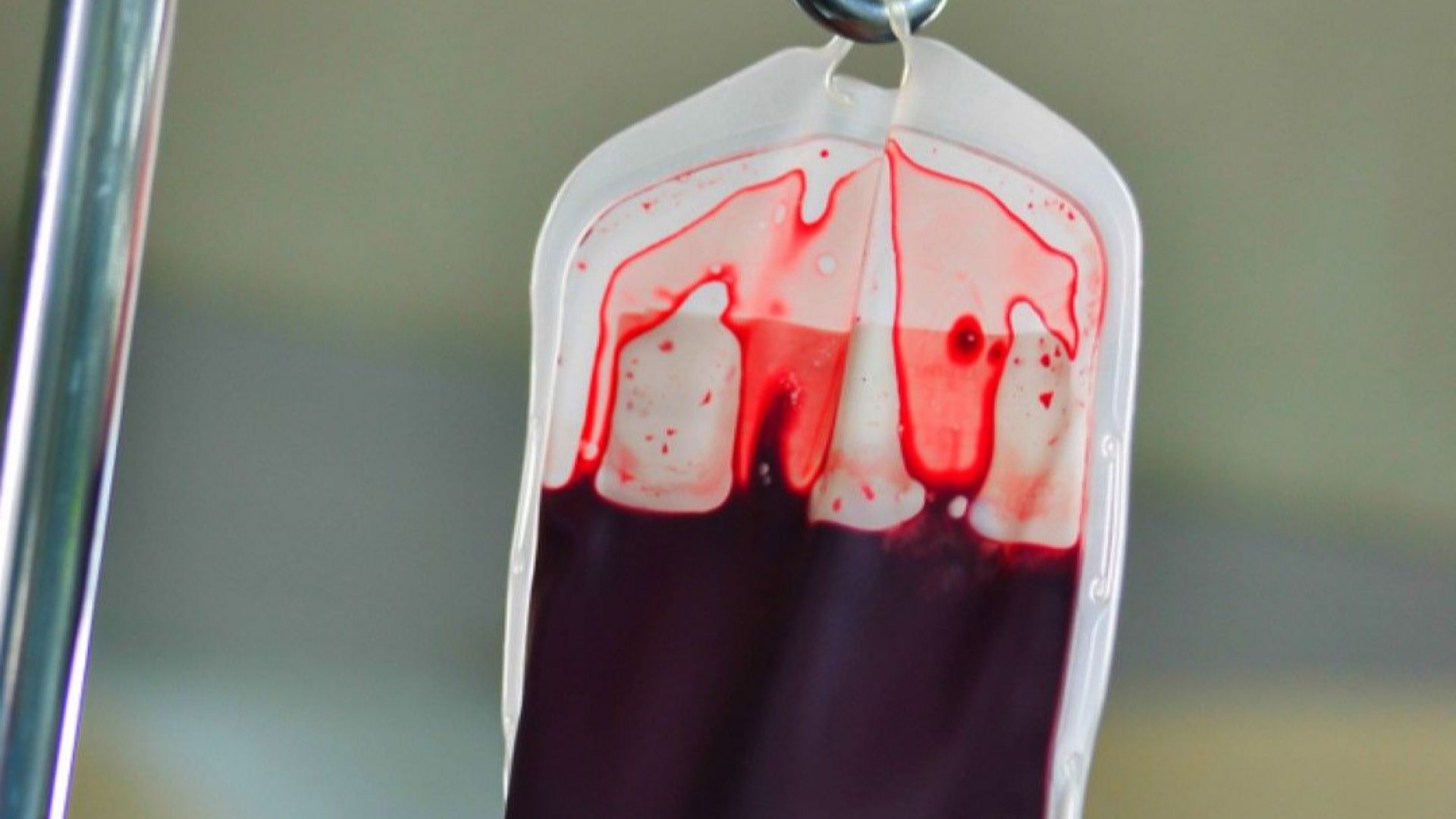 Десетки дариха кръв за пострадалата бременна жена
