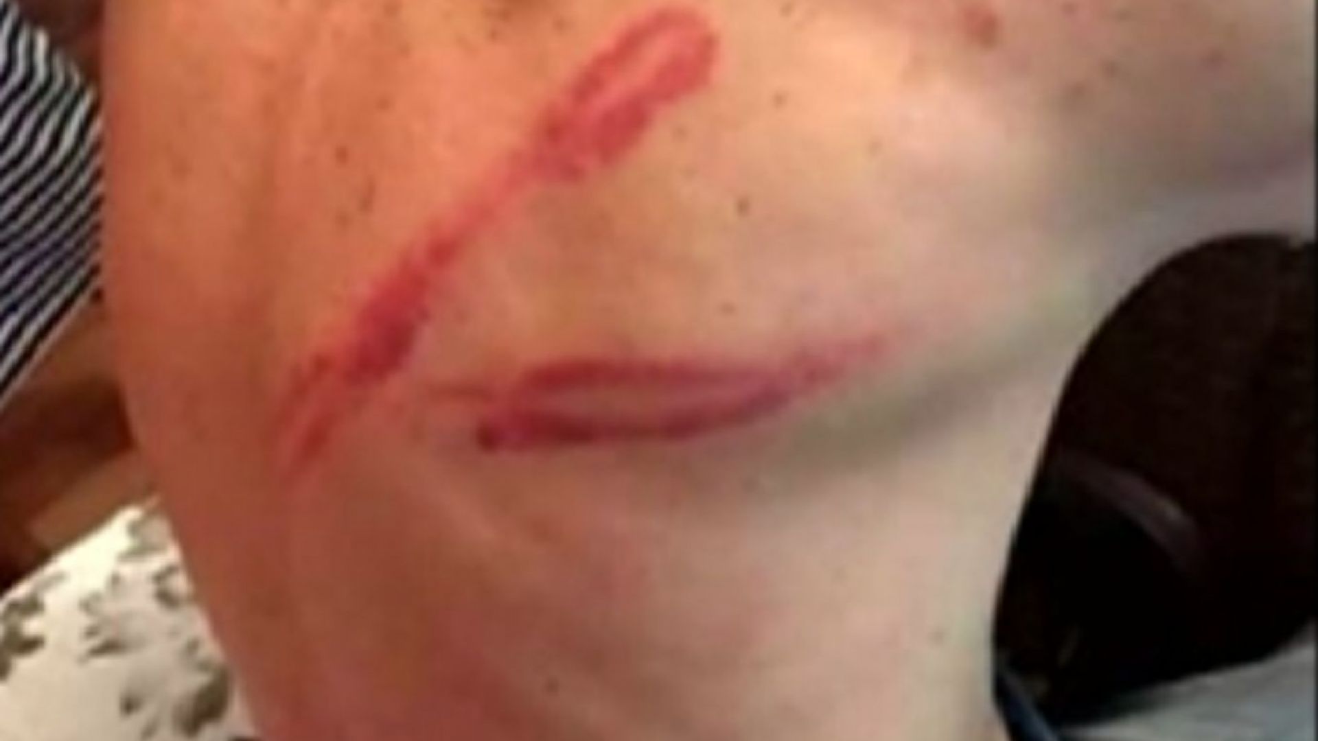 Жители на пазарджишкия квартал Изток твърдят че са бити от