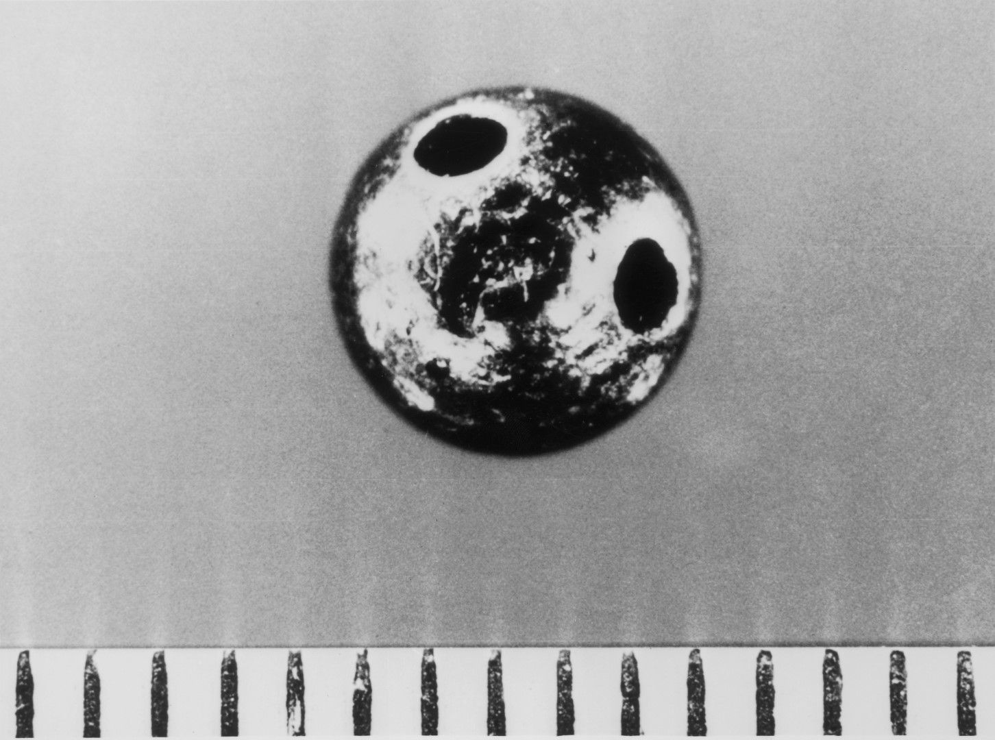 30 септември 1978 г. Миниатюрната платинена сачма с рицин, извадена от крака на Георги Марков