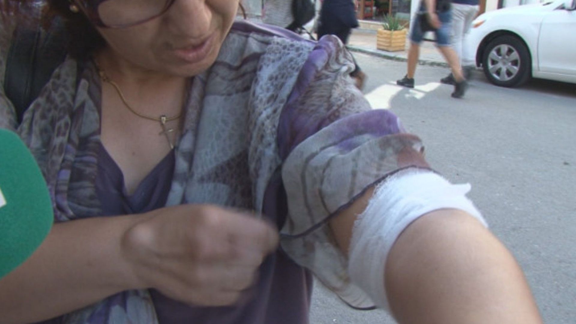 Ротвайлер нахапа минаваща край него жена в центъра на Бургас