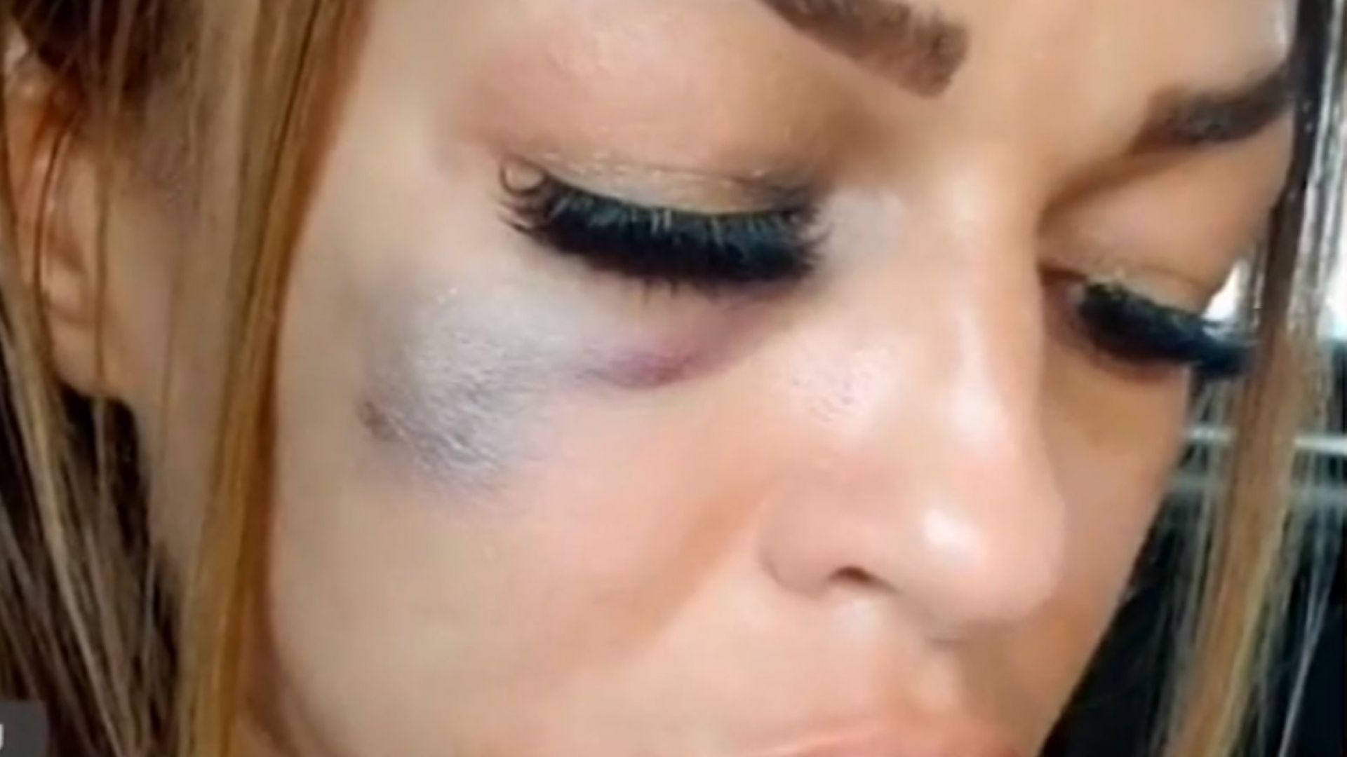 Жена от Сандански твърди че е била брутално пребита на