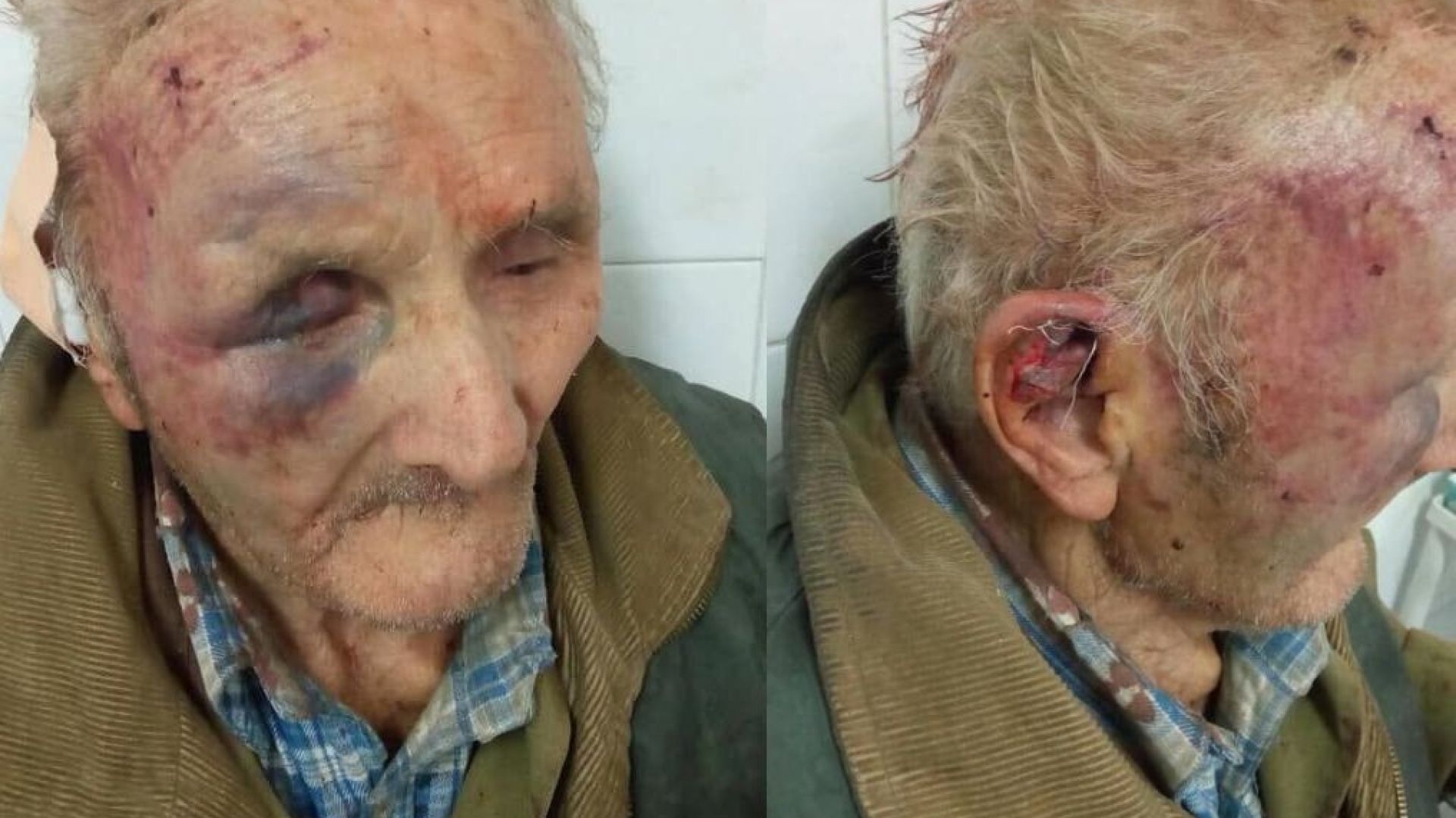 36-годишният мъж, който нападна и преби жестоко 82-годишния Георги Вачев