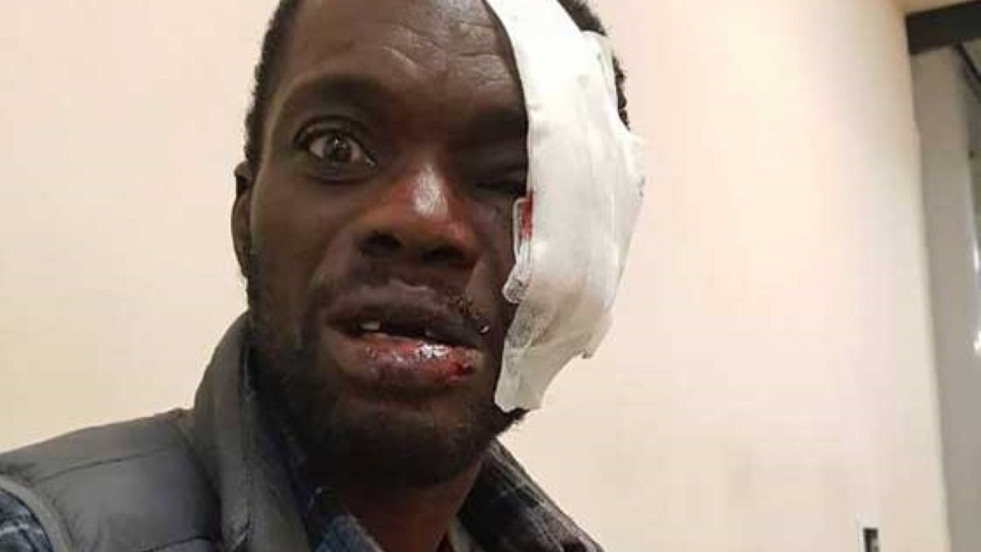 Британски гражданин е станал жертва на тежък побой от страна