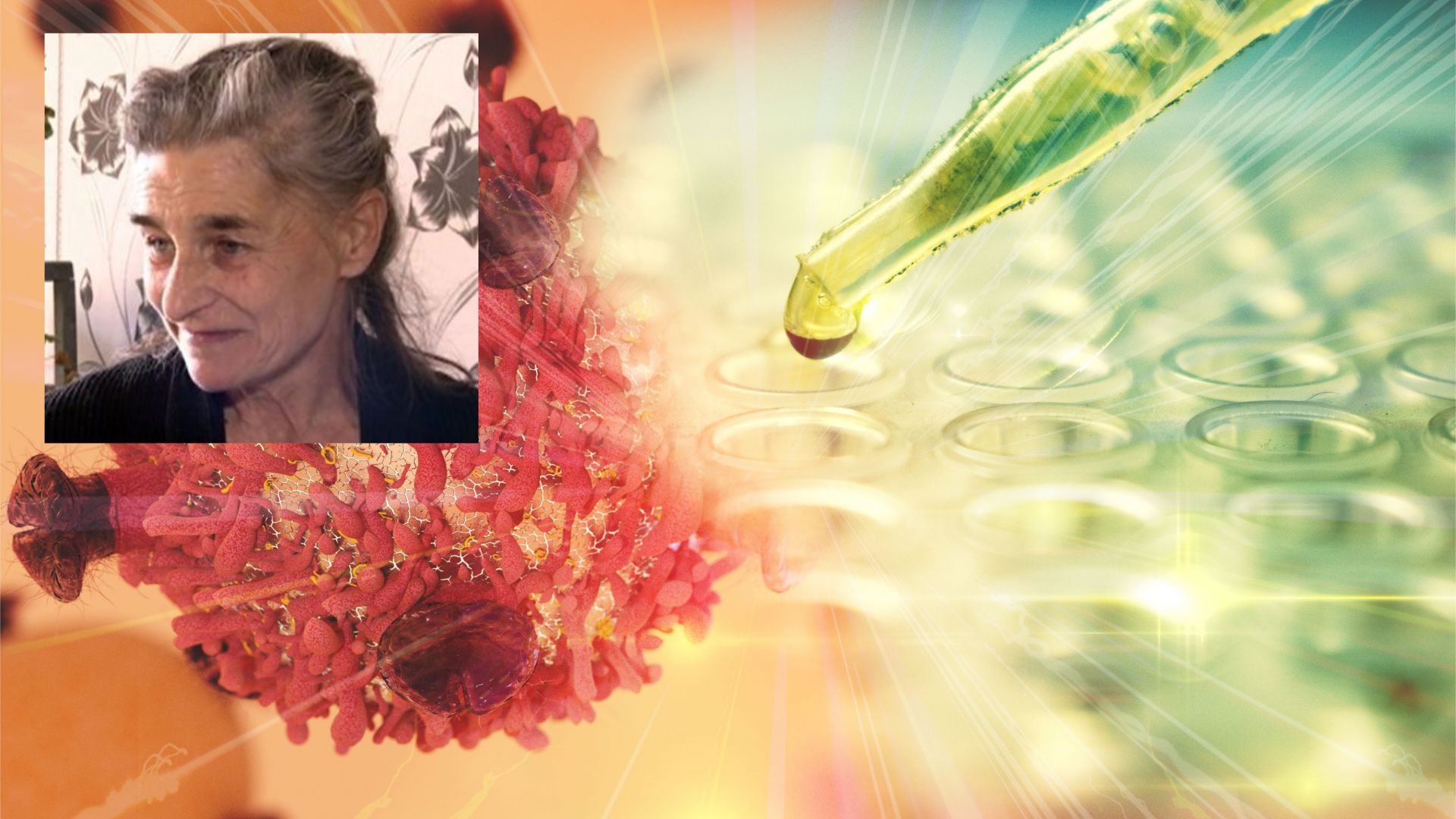 Три големи университетски болници се обединиха за да спасят живота