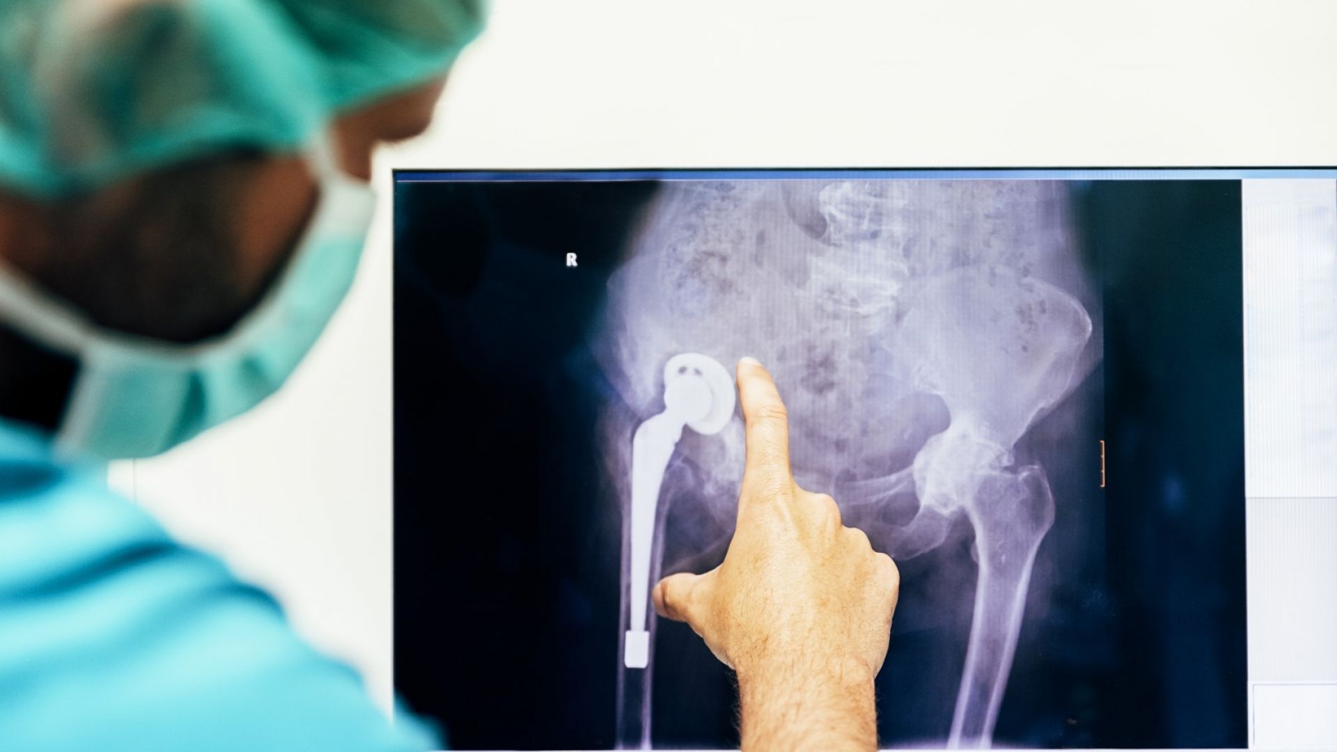 Implant Files: Дефектни протези убиват десетки хиляди и увреждат милиони пациенти по цял свят