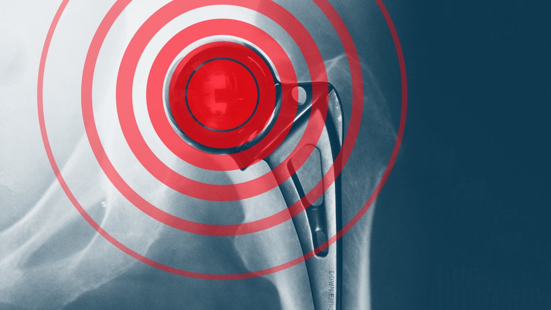 Разследване на стотици журналисти срещу глобалната медицинска индустрия беше публикувано