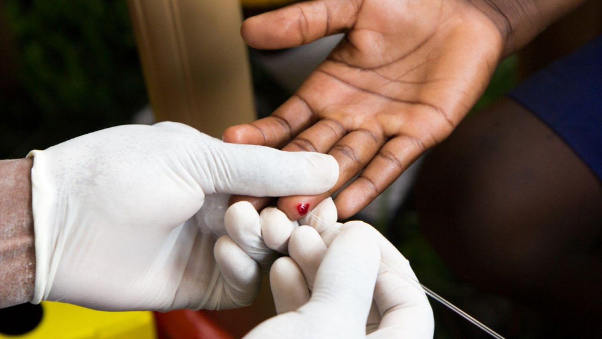 Днес отбелязваме Световния ден за борба с ХИВ и СПИН