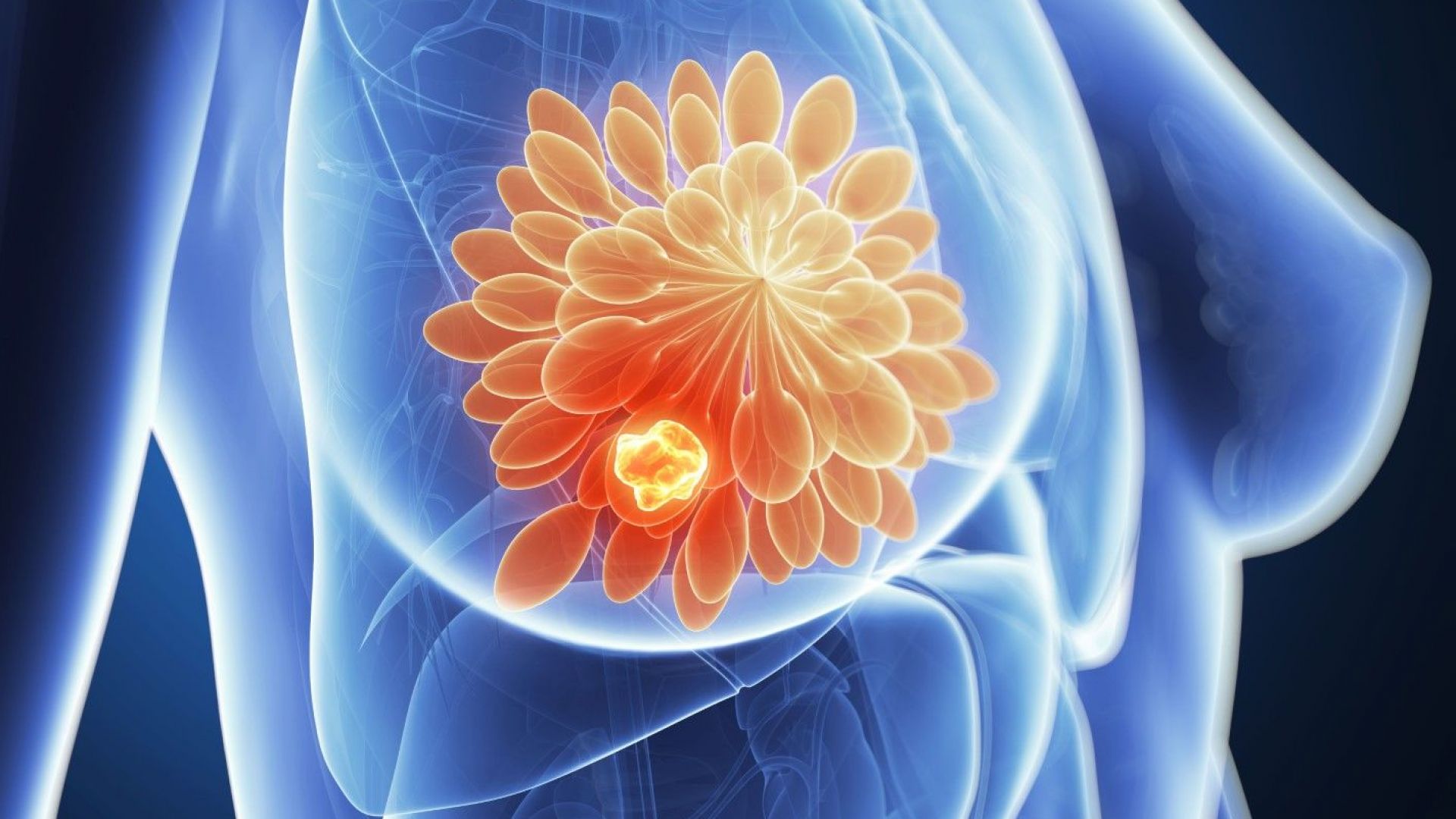 Кръвен тест за откриване на туморни клетки ще помогне за