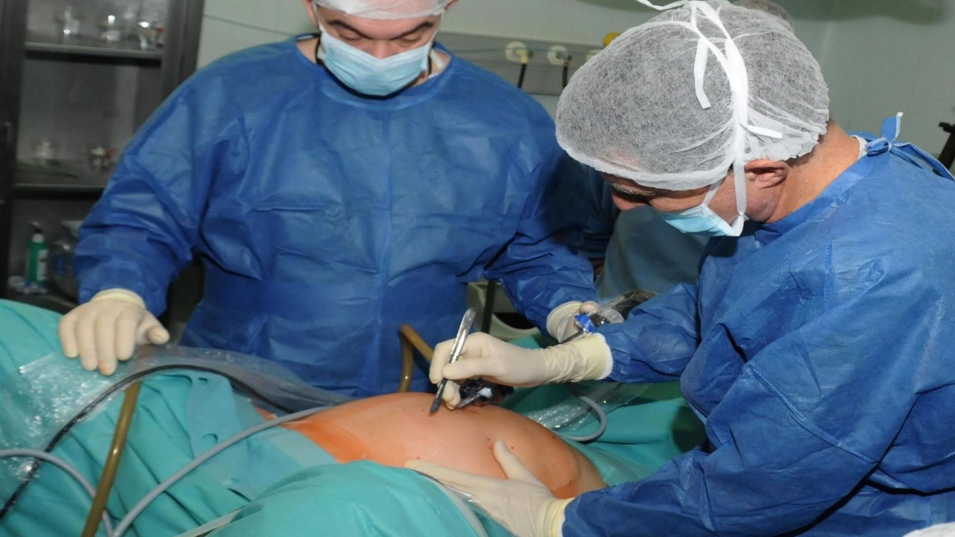 Трета трансплантация на черен дроб извършиха в рамките на две