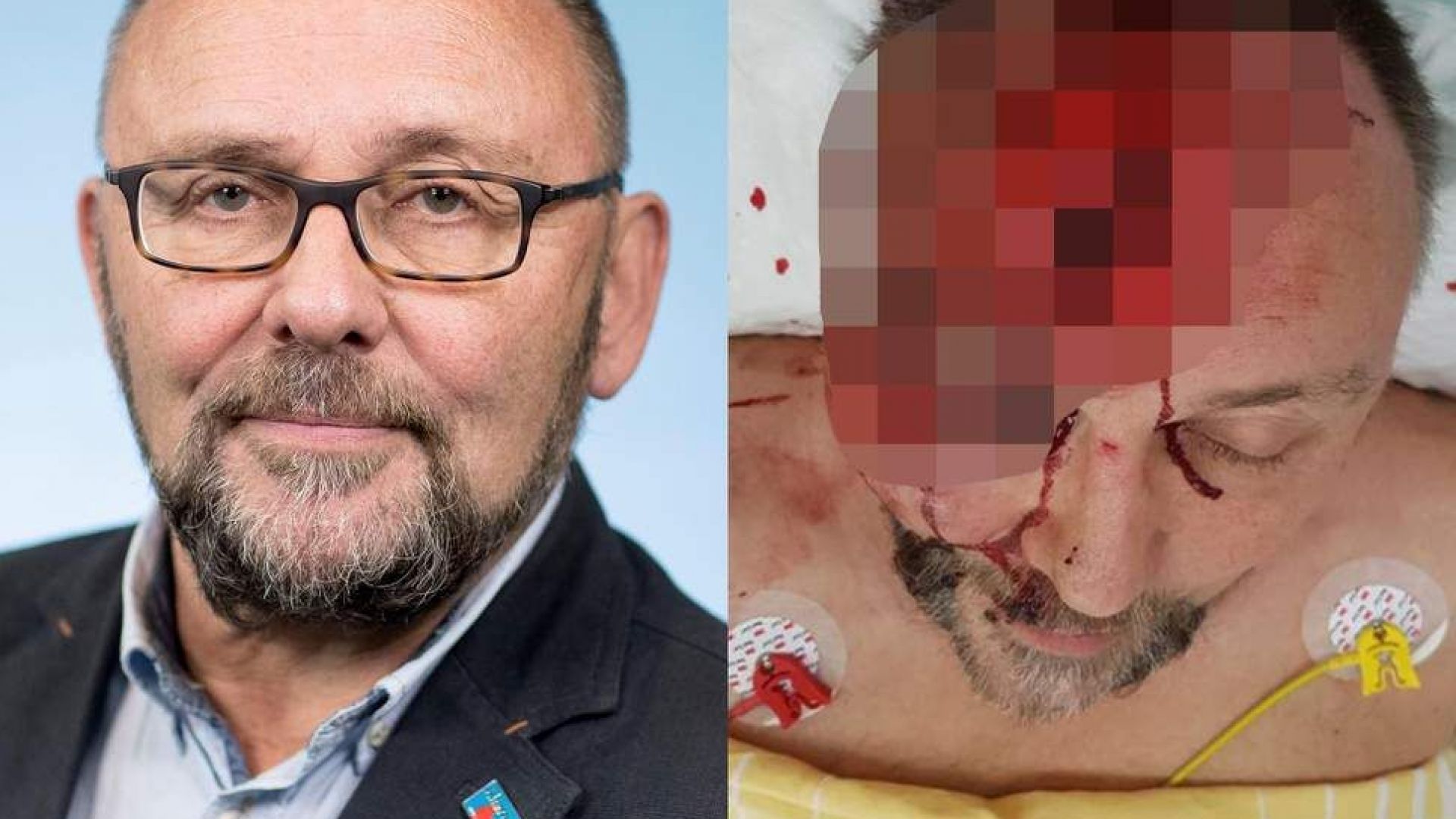 Подлото и животозастрашаващо нападение срещу Франк Магниц е резултат от