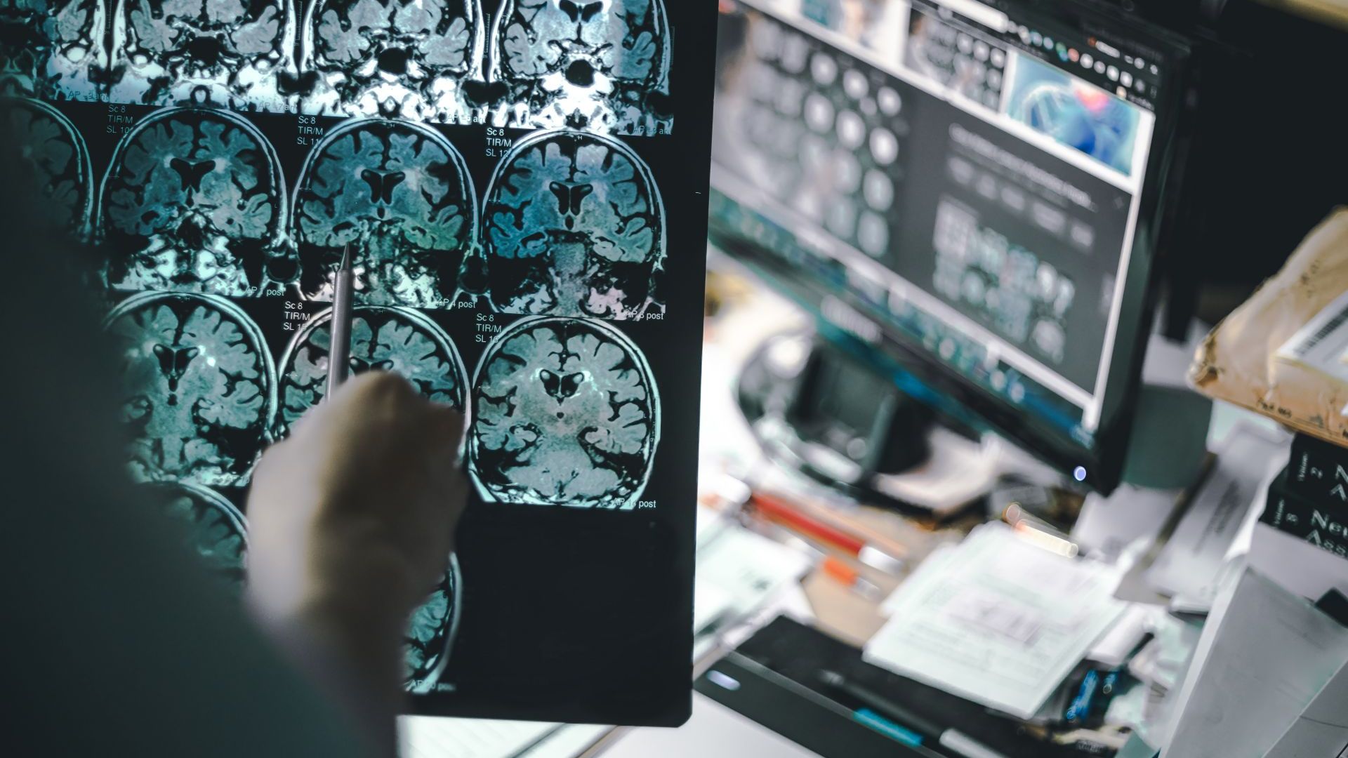 Промени в нивата на протеините в кръвта могат да помогнат