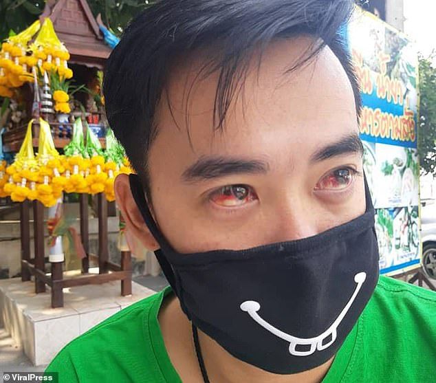 На някои от жителите на Банкок им тече кръв от очите заради мръсния въздух