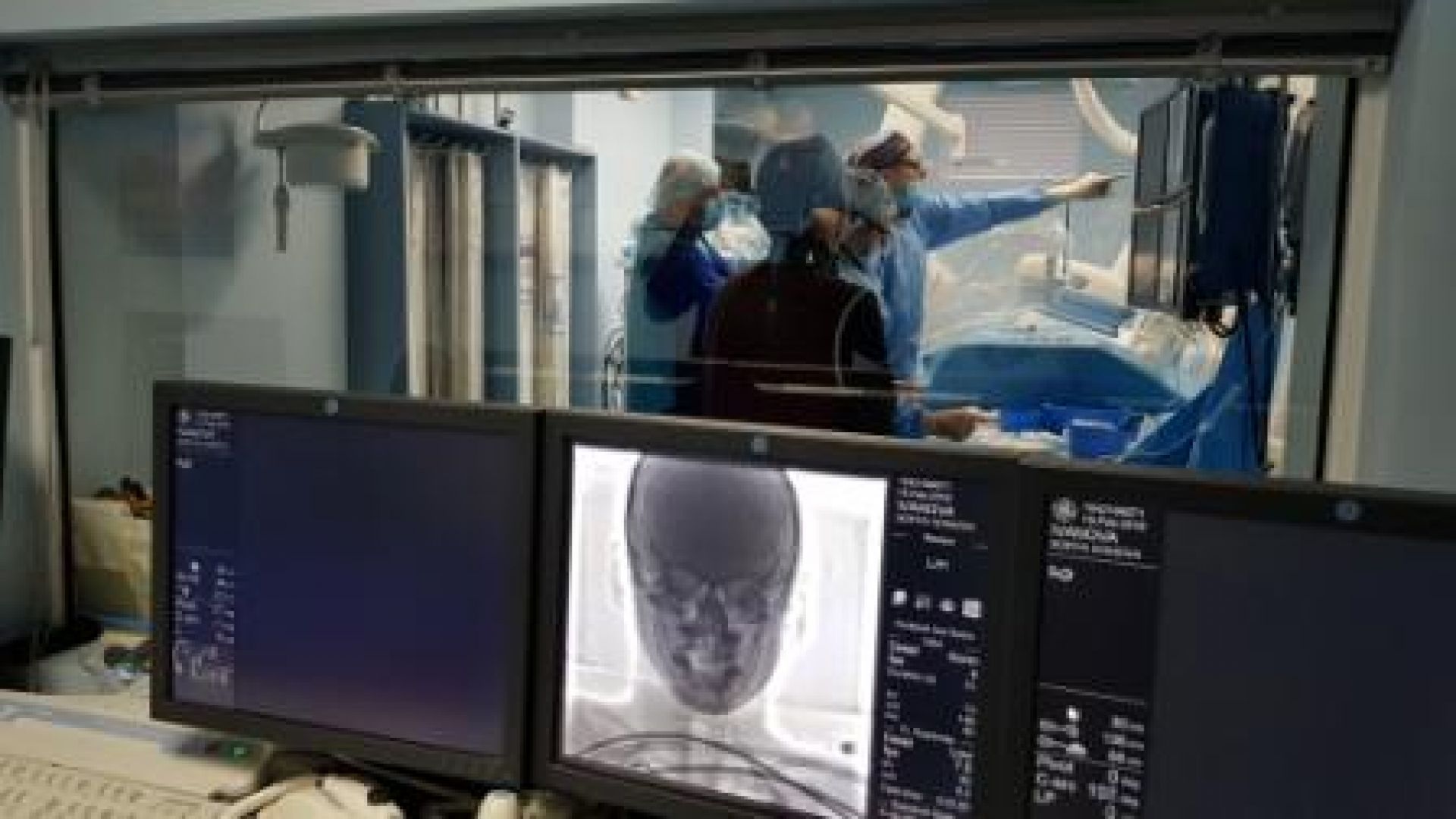 Уникални мозъчни операции бяха извършена в столичната болница Св Иван