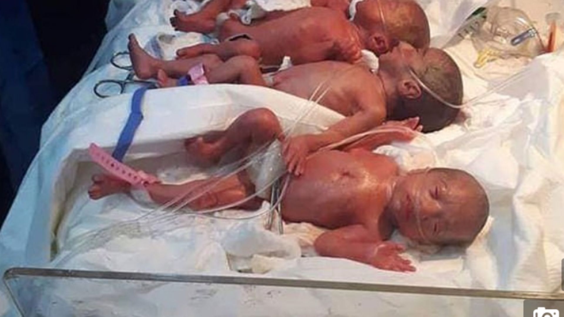 25-годишна многодетна майка роди седем близначета - шест момиченца и