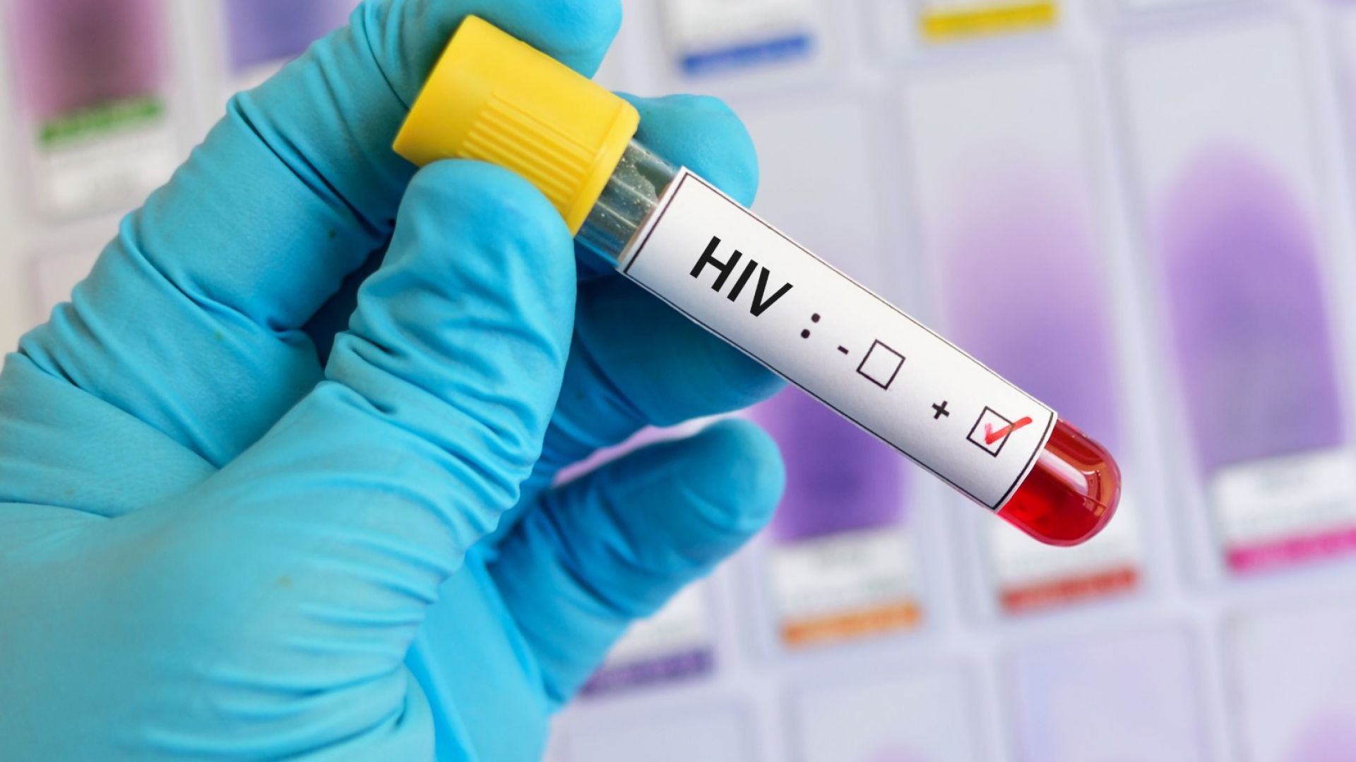 183 души с ХИВ са регистрирани у нас тази година, най-много са между 30 и 39 г.