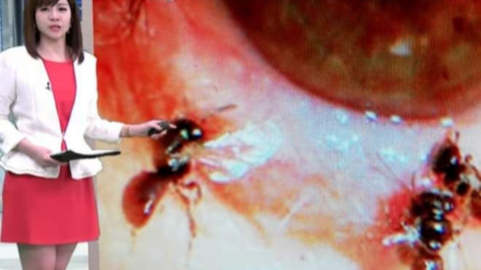 Офталмолози откриха в окото на 29-годишна тайванка 4 живи пчели,