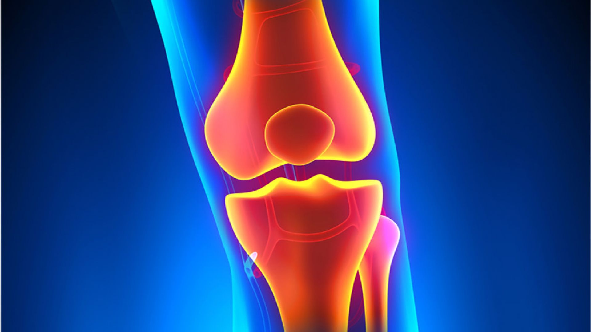 Болката в коленете идва изведнъж а може да ни прикове