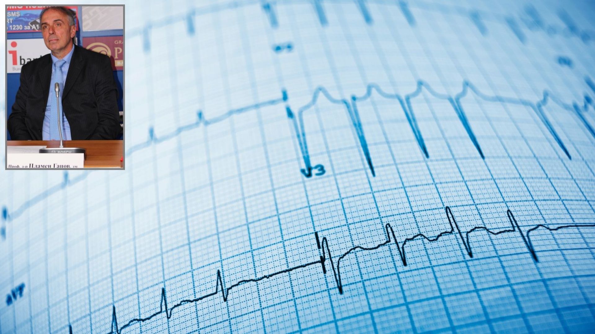 Сърдечно съдовите заболявания имат социална значимост и роля за влошените здравни