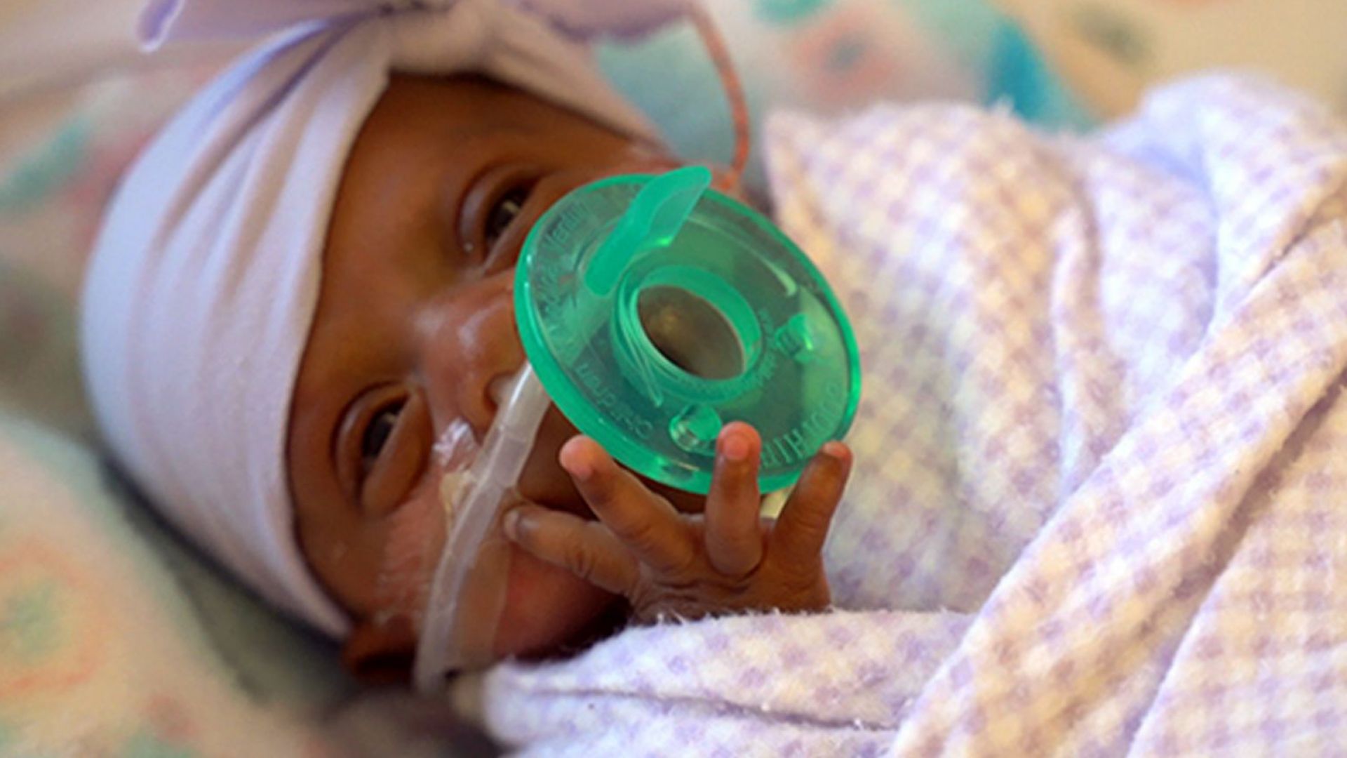 Калифорнийска болница съобщи за раждането на най малкото бебе в света