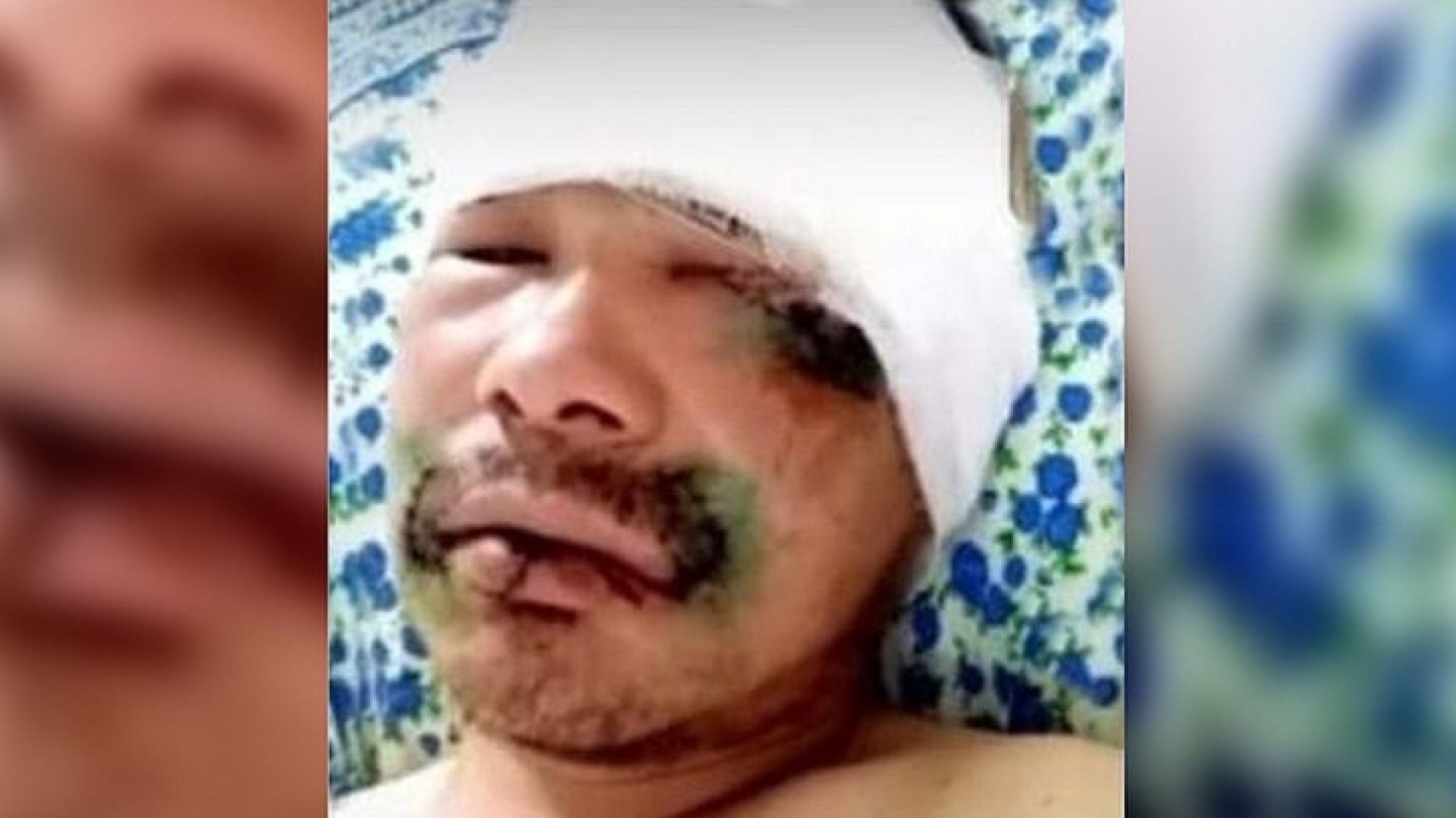 Руснак който бил изненадващо нападнат от мечка успял да я