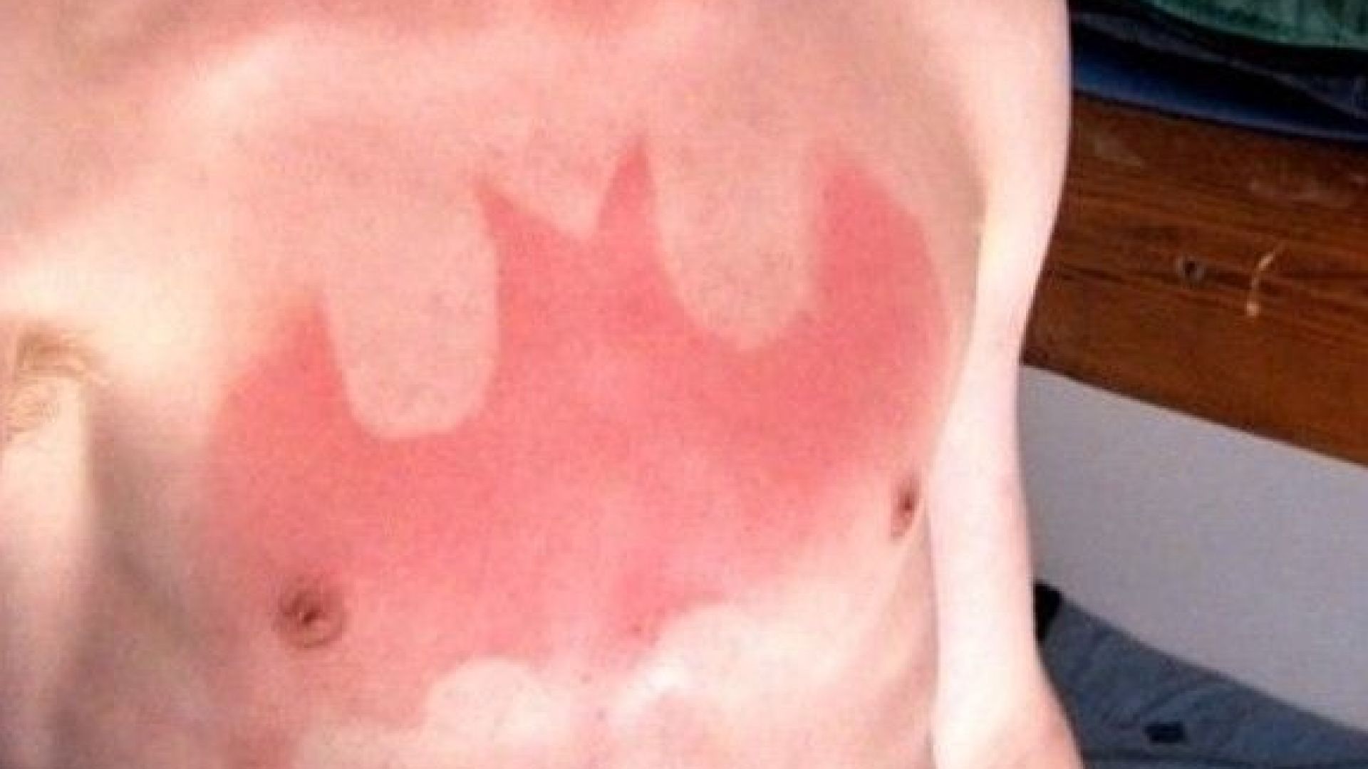 Татуировки - изгорени на слънце - най-лошата тенденция