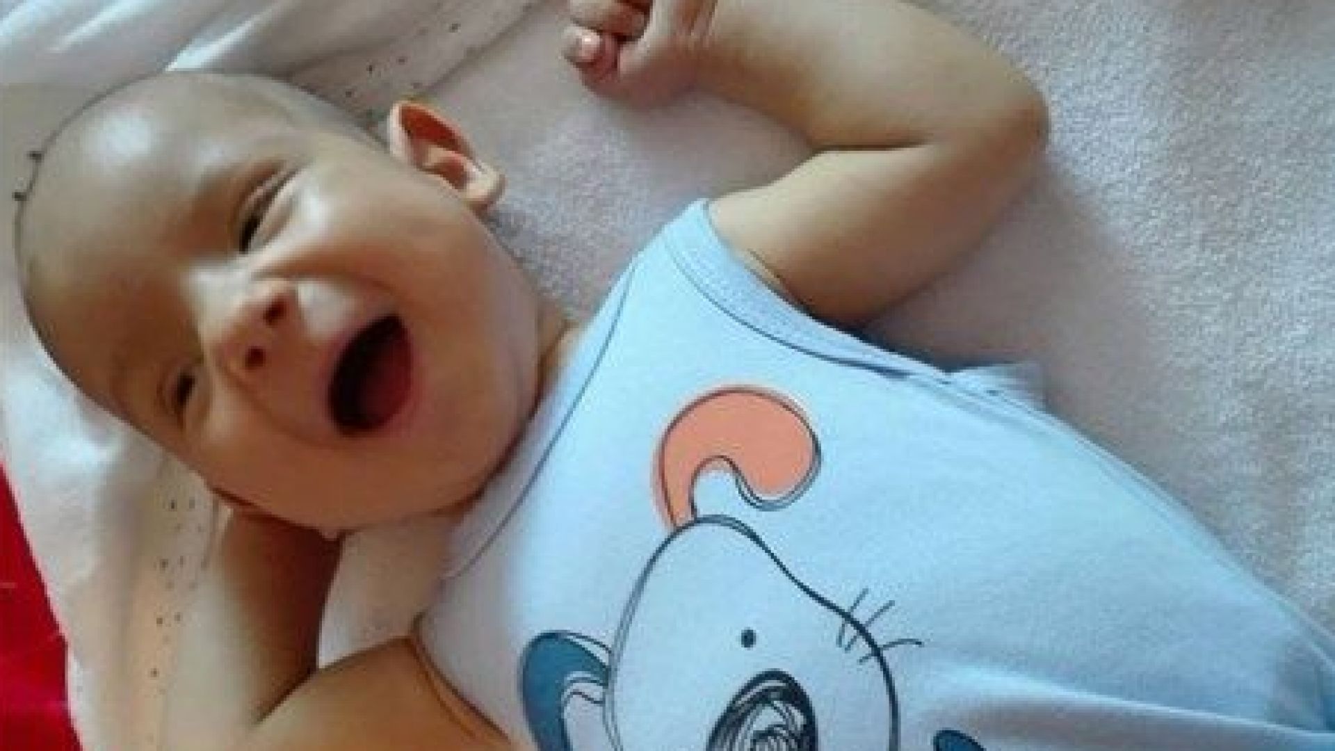 Успешно мина трансплантацията на черен дроб на 5 месечния Алекс Операцията