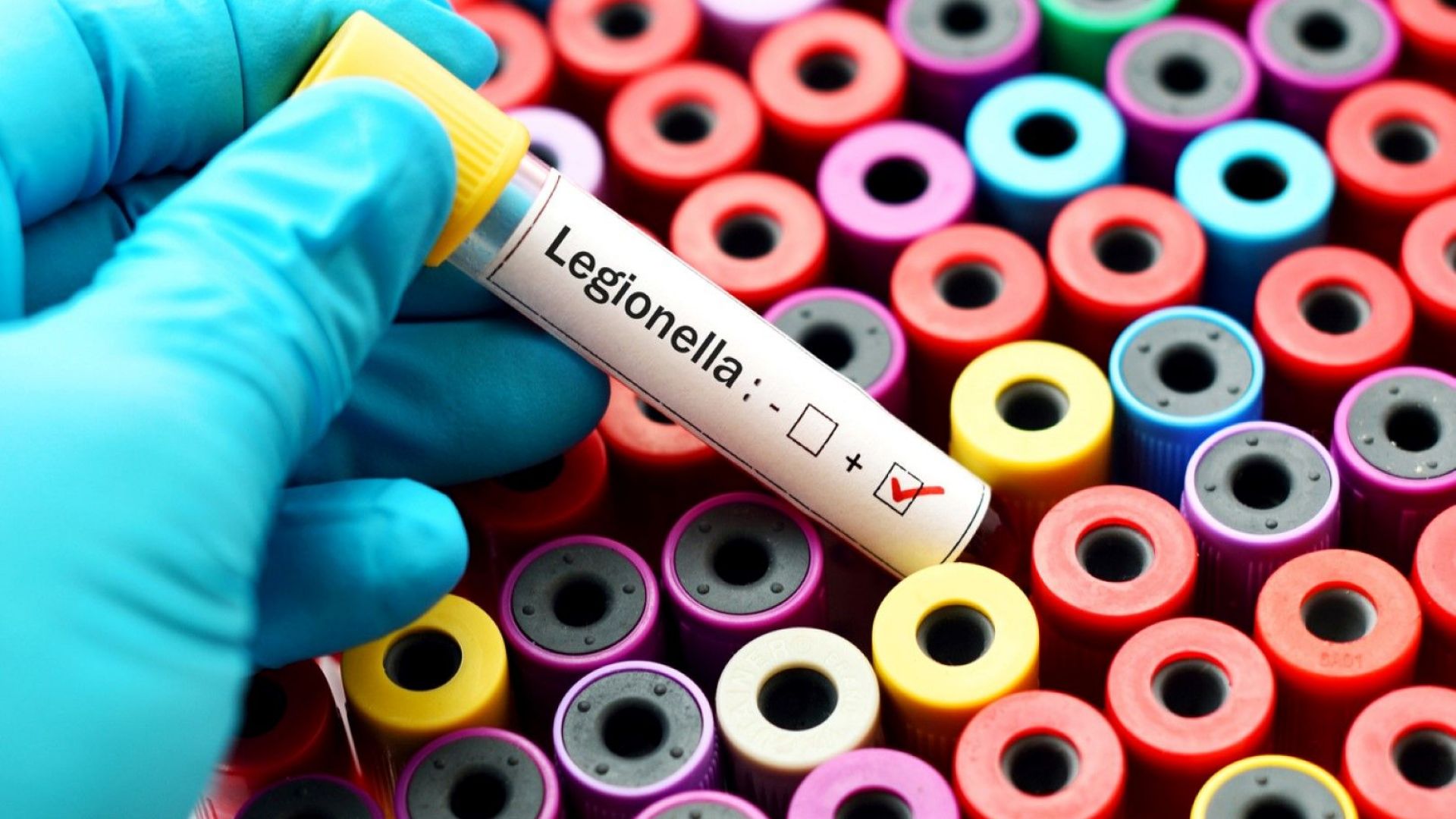 Ежегодно в Европа се регистрират по около 10 000 случая