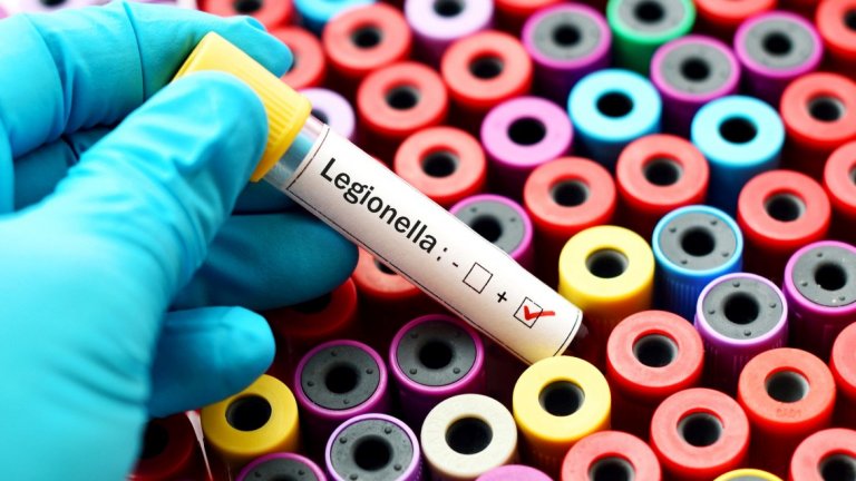 Възрастна бургазлийка почина от легионерска болест след пътуване в Турция