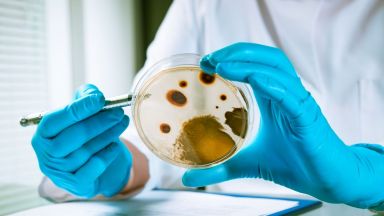 Случаи на листериоза инфекция с хранителен произход свързана с