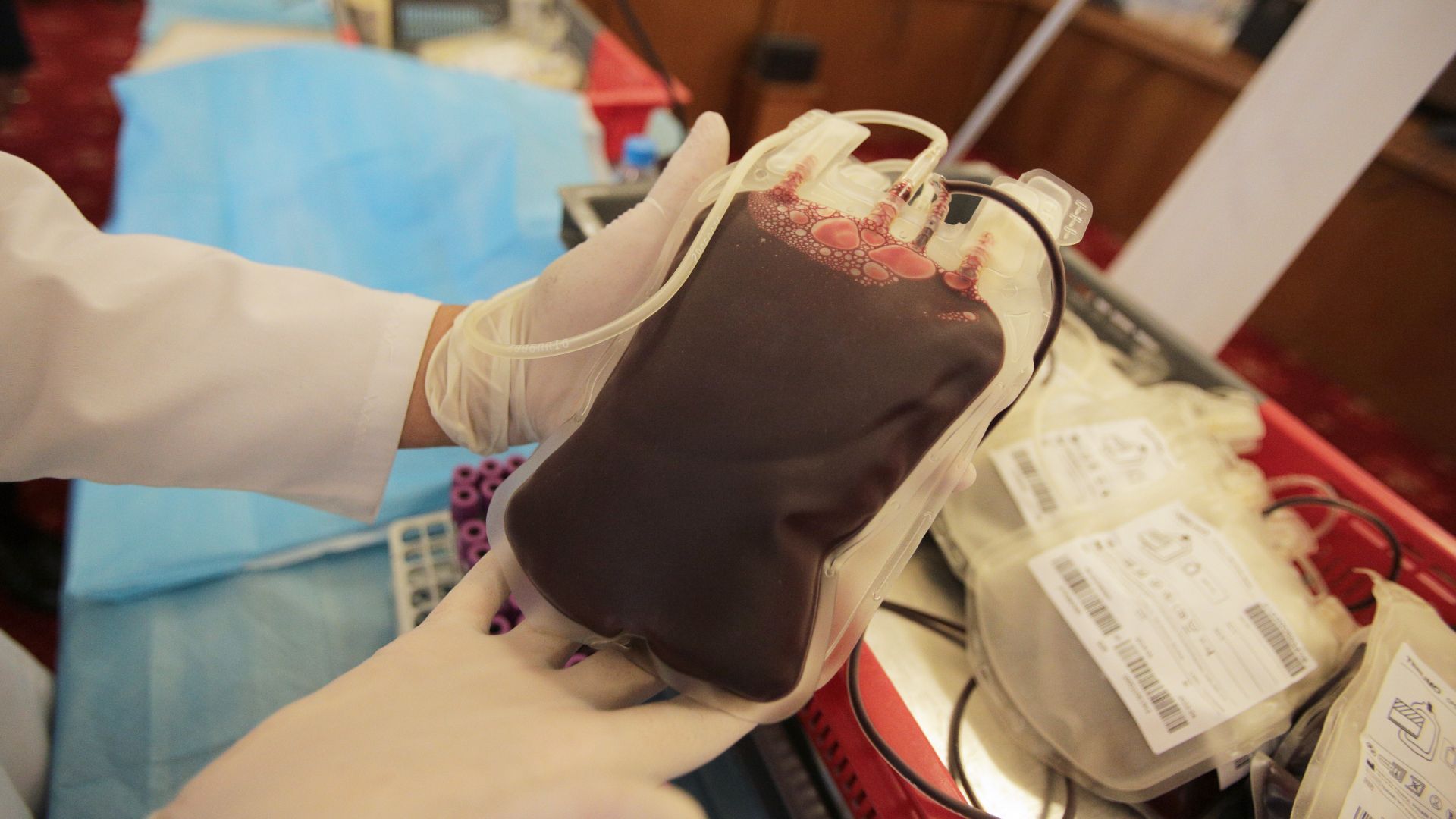 За първи път в света: Преляха на човек лабораторно отгледани червени кръвни клетки