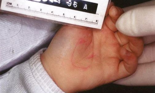 На лявата ръчичка имало нарисувана с червено мастило фигура, наподобяваща сърце