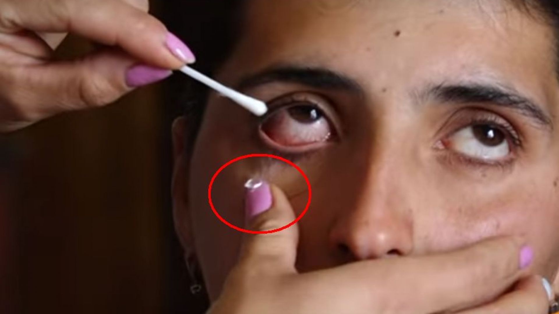 Арменско момичe плаче кристали, озадачава лекарите (видео)