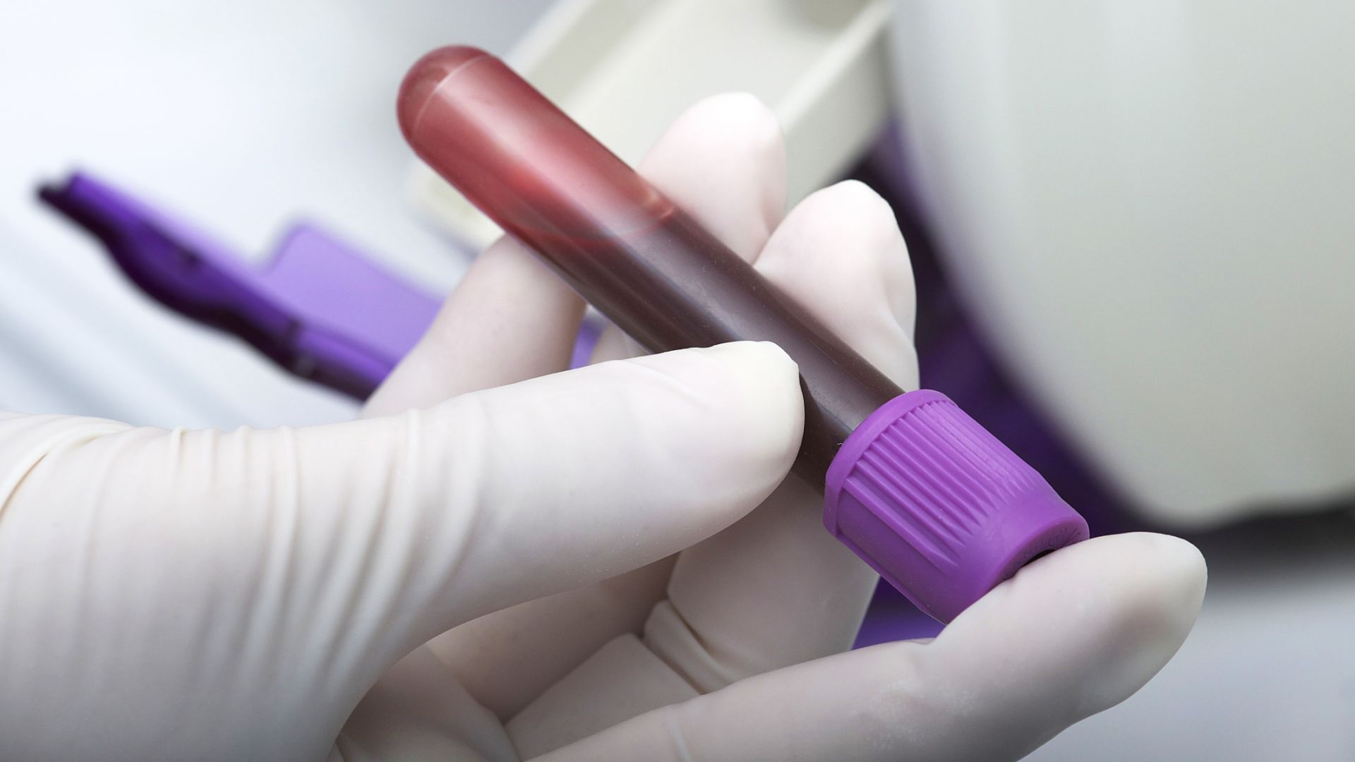 Всяка дарена кръв вече ще бъде изследвана с NAT технология
