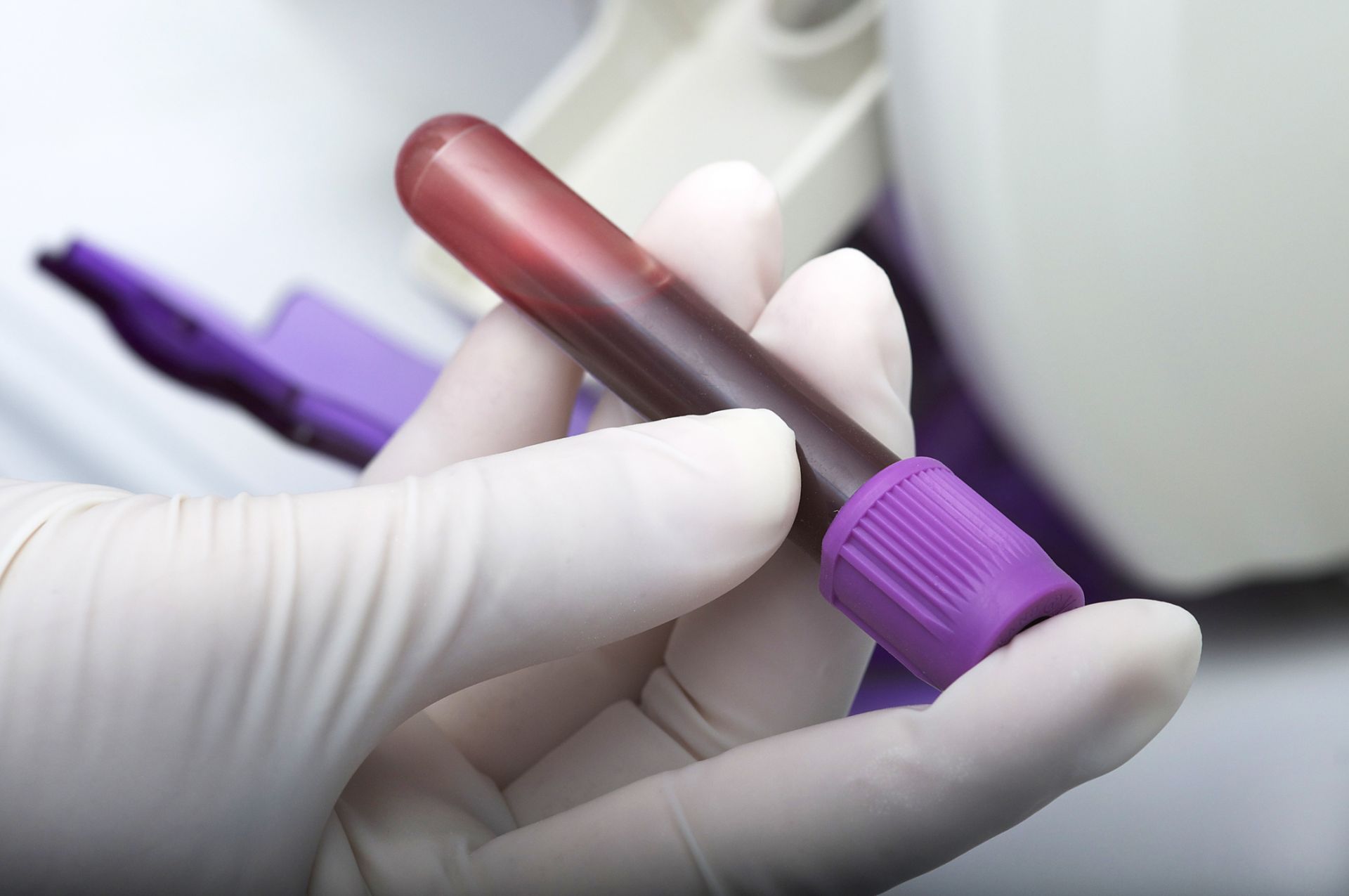 Република Турция ще дари на България лични предпазни средства и диагностични тестове за новия коронавирус COVID-19