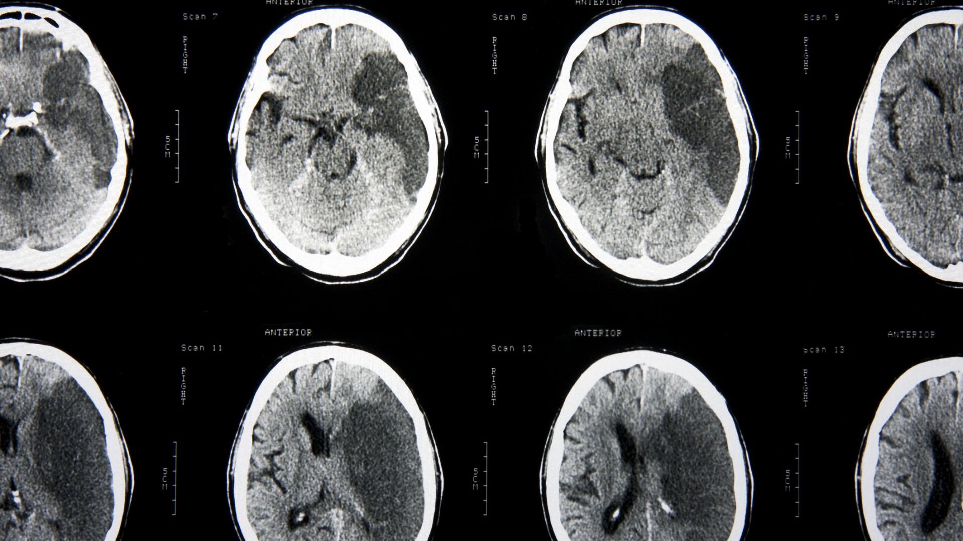 Във Видин Враца Монтана Сливен и Ямбол засега няма нито