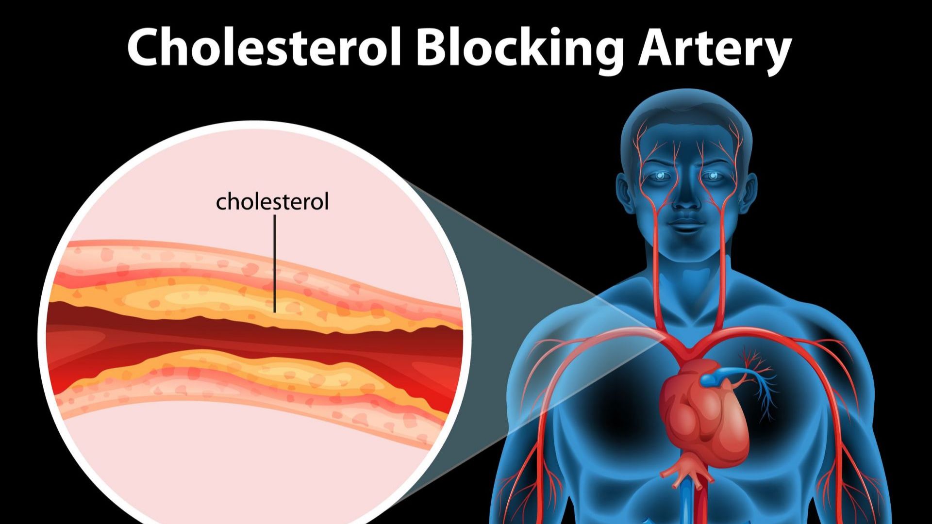 Холестерол под контрол без химически лекарства