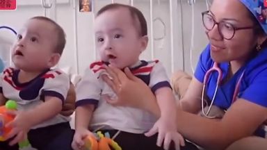 По Коледа стават чудеса - разделени сиамски близнаци се прибраха у дома (видео)