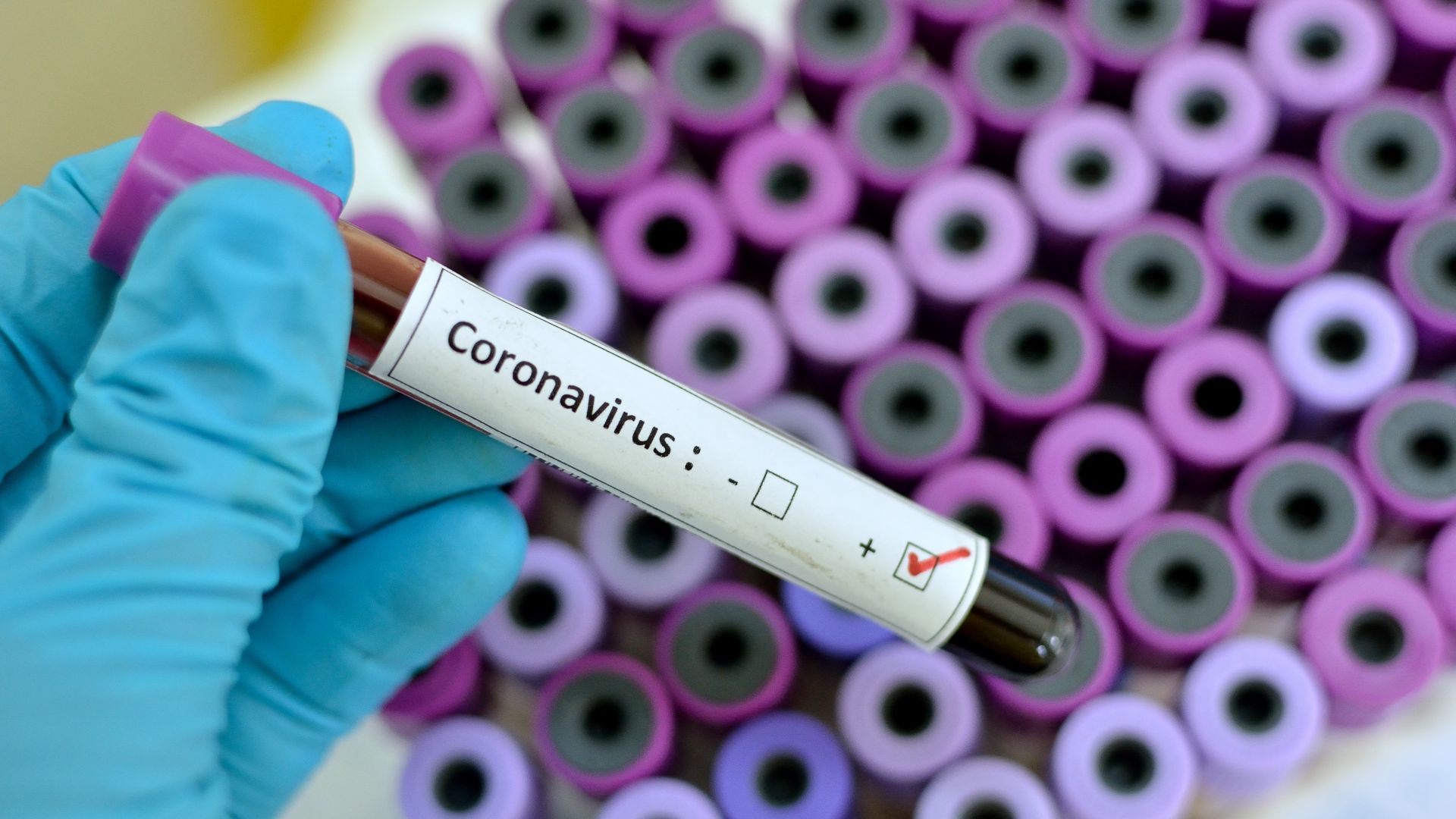 Китай е снабдил Русия с генома на новия коронавирус и