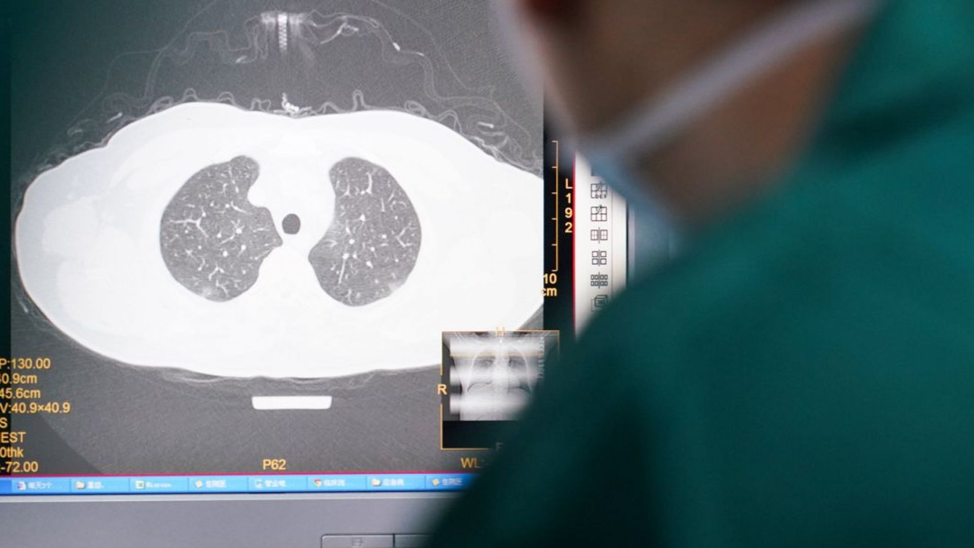 Тайландски лекари постигат успех при лечението на тежки случаи с