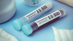От Хонконг - за новото лекарство срещу COVID-19