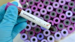 Париж представя първите резултати за лечение на Covid-19