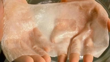 Учени заличават белезите от изгаряне чрез "принтиране на кожа"