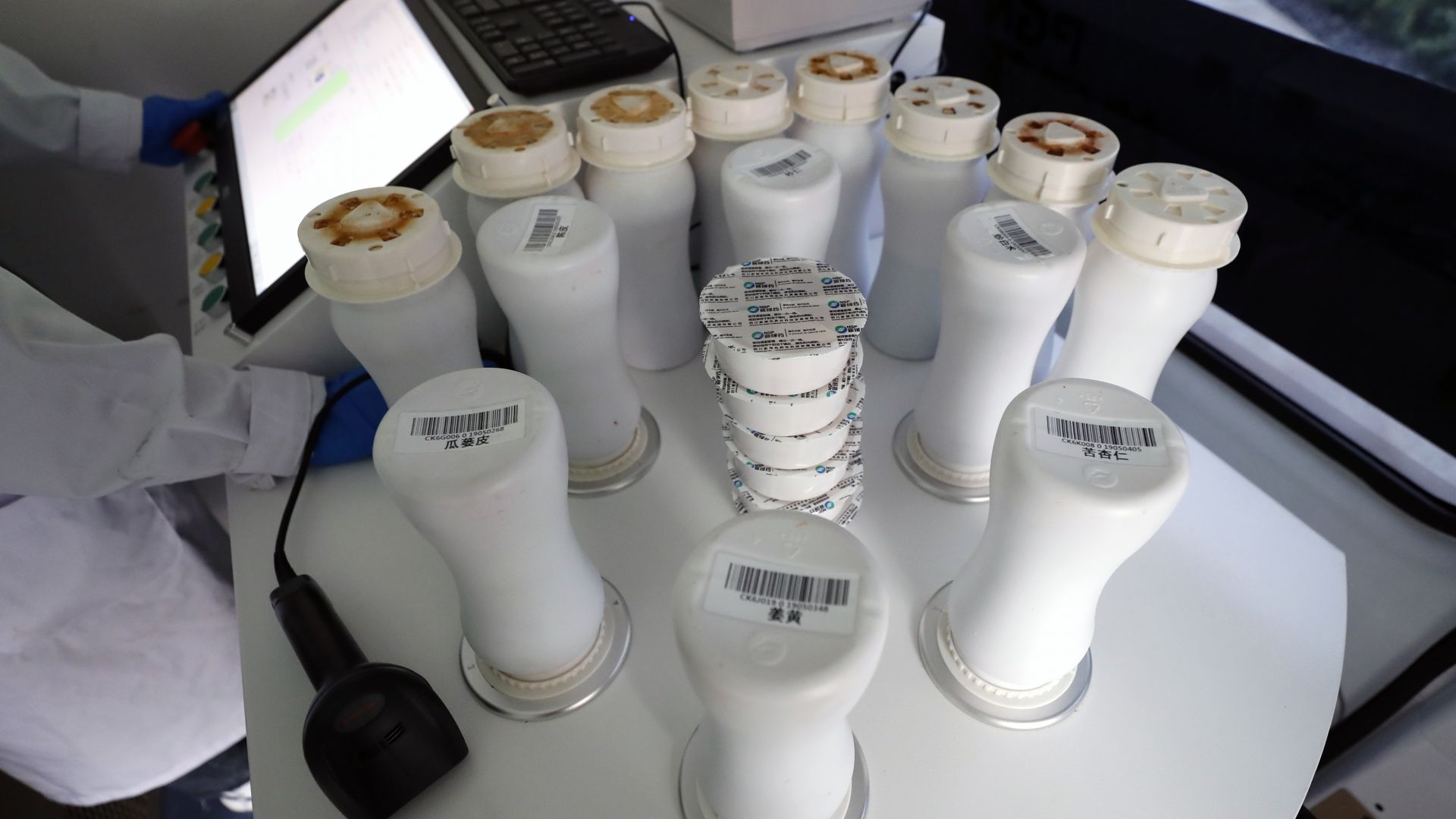 Резултатите от пробите на двете жени настанени в инфекциозното отделение