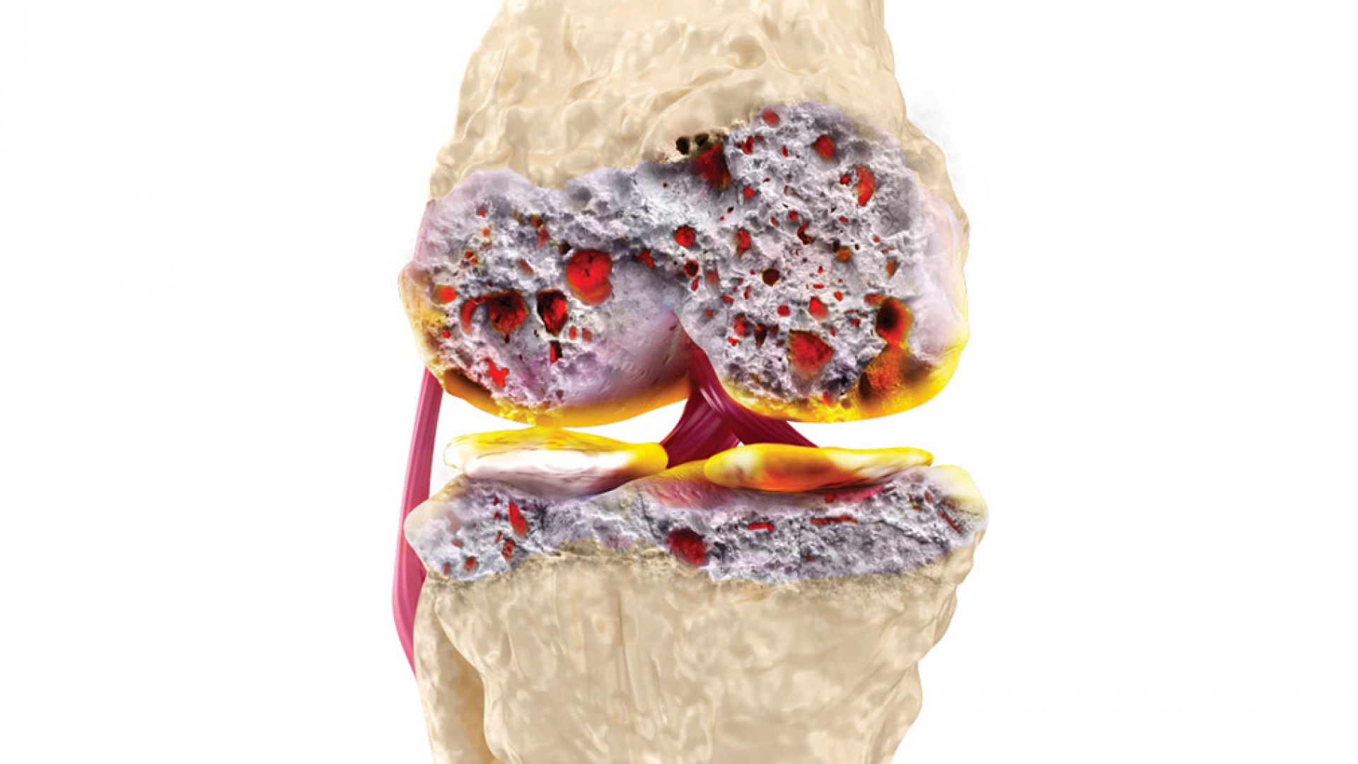 А те могат да бъдат причинени както от обикновената смяна