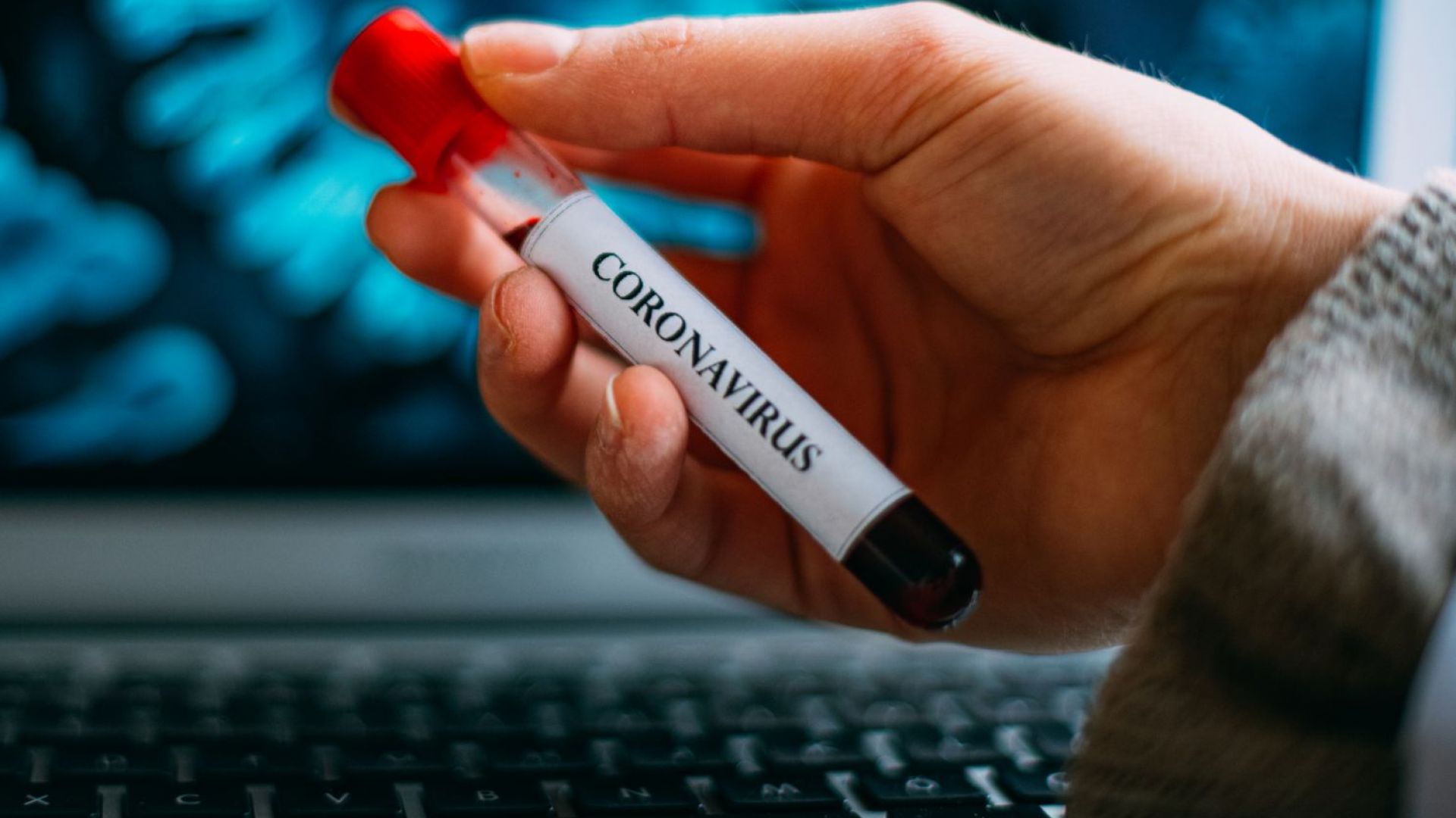 Има първа положителна проба за COVID 19 във Варна съобщи пред