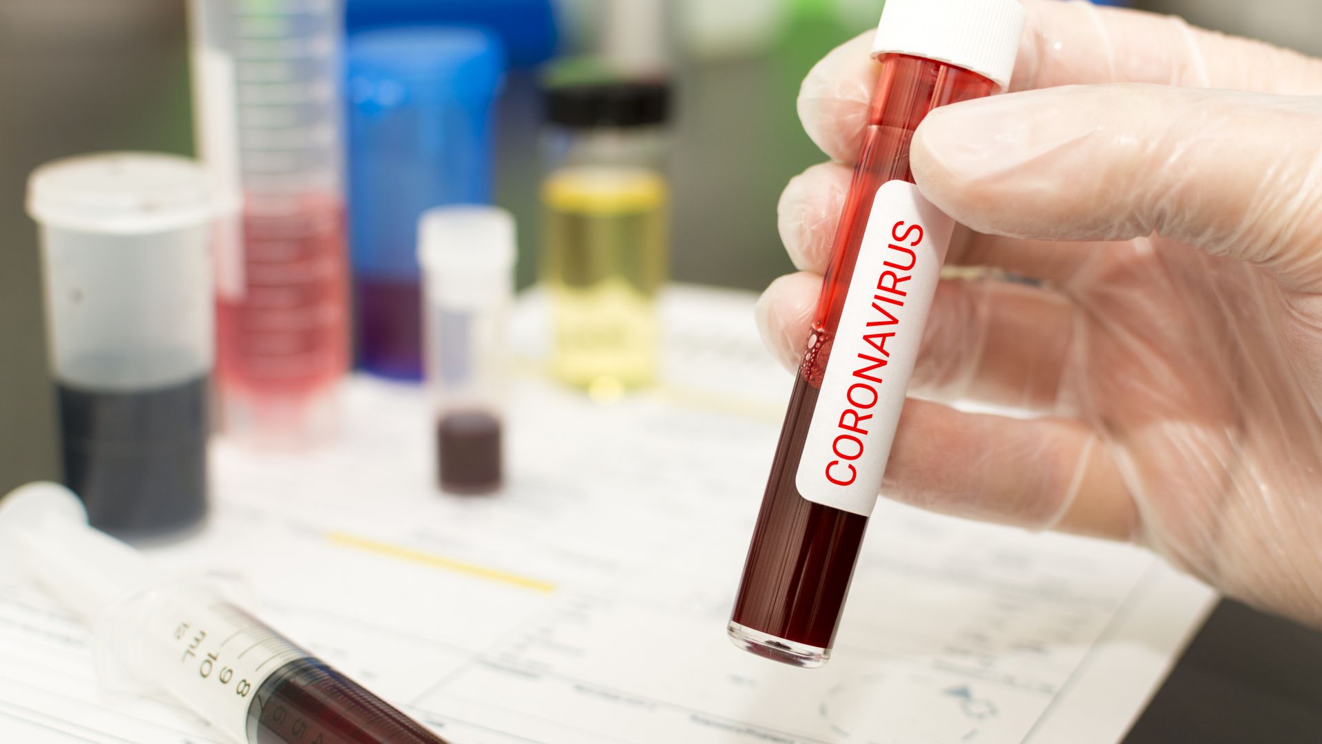 Преобладаващата част от смъртните случаи предизвикани от коронавируса са при